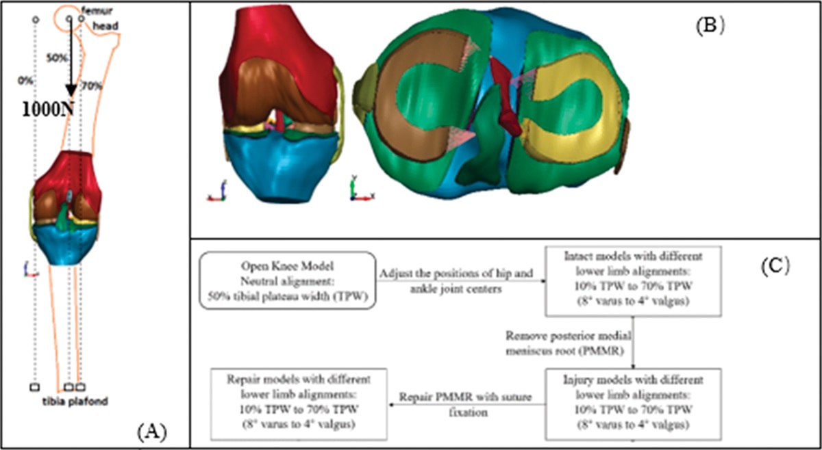 The Effect of Lower Limb Alignment on Tibiofemoral Joint Contact Biomechanics after Medial Meniscus Posterior Root Repair: A Finite-Element Analysis