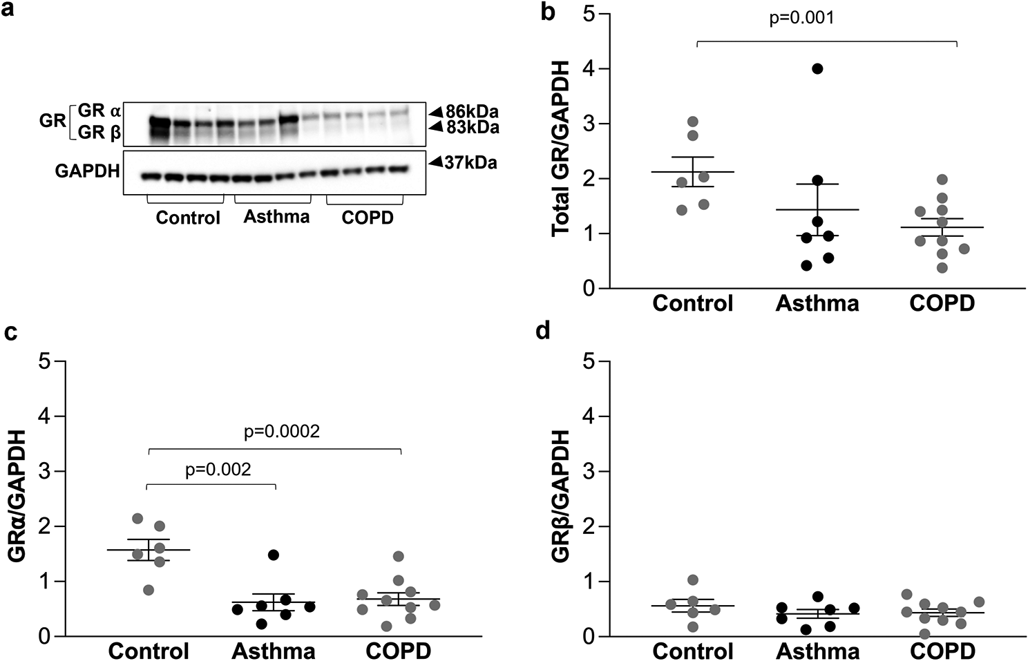 Expression of glucocorticoid receptor and HDACs in airway smooth muscle cells is associated with response to steroids in COPD