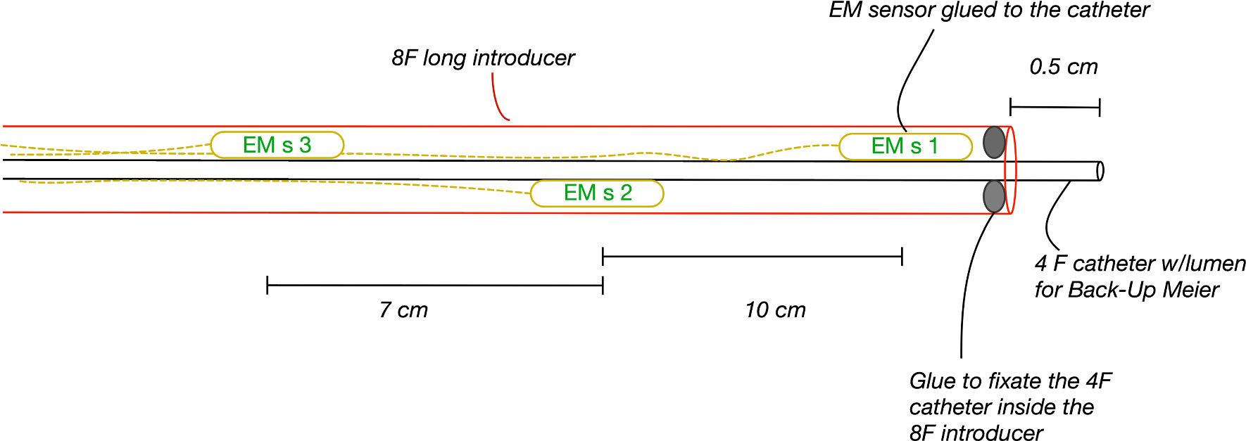 Aortic roadmapping during EVAR: a combined FEM–EM tracking feasibility study