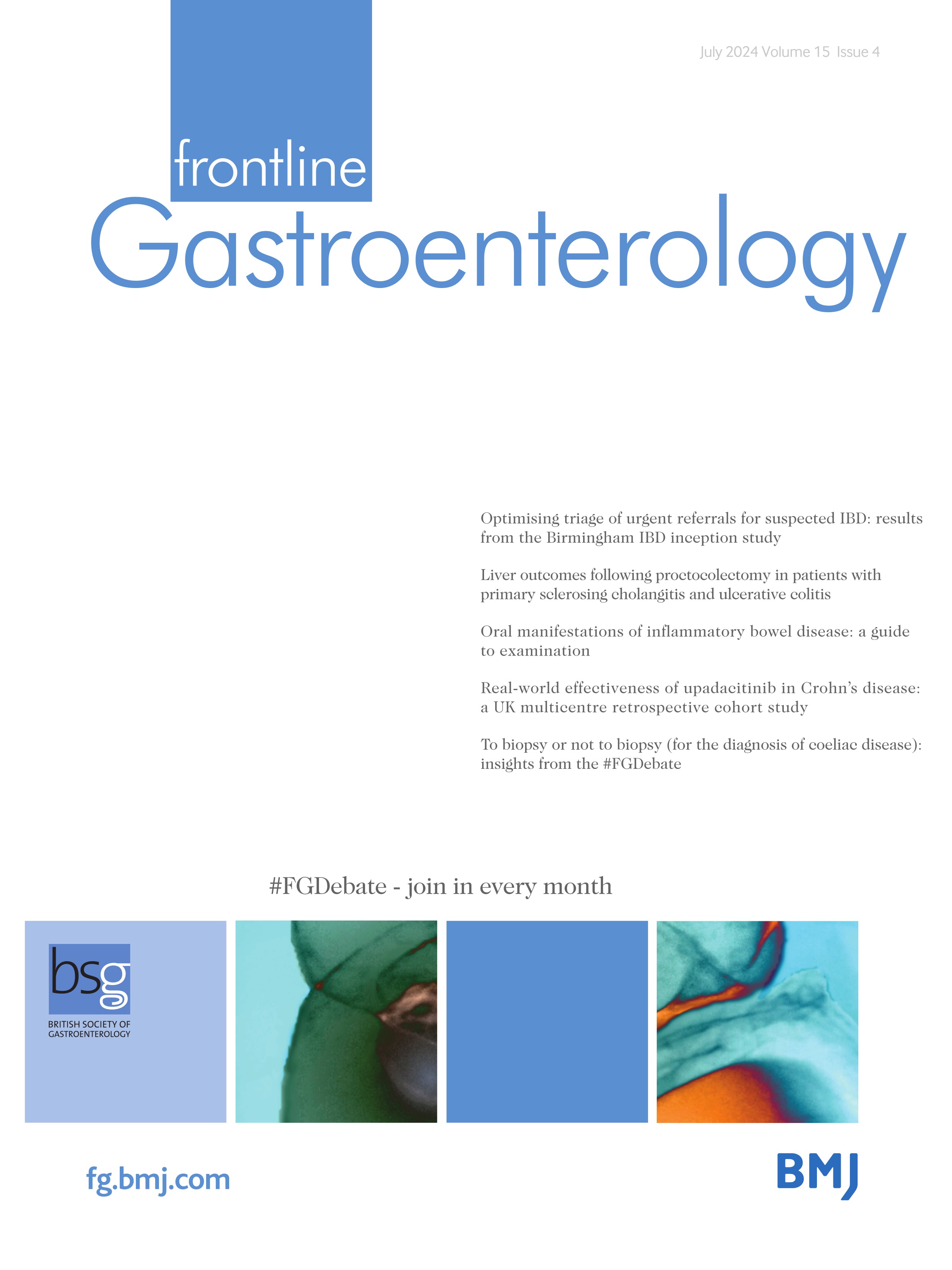 Liver outcomes following proctocolectomy in patients with primary sclerosing cholangitis and ulcerative colitis