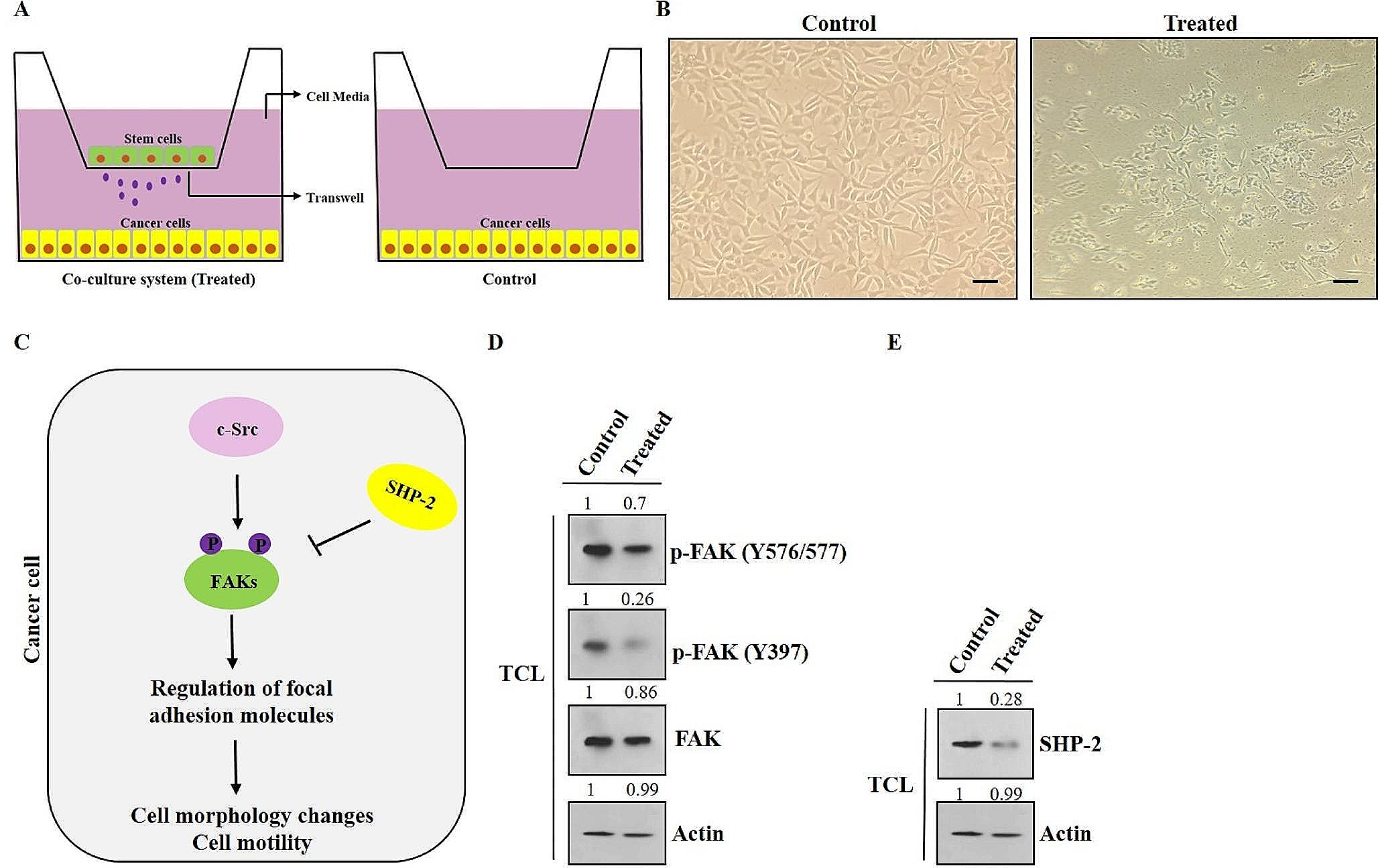 The suppression of cell motility through the reduction of FAK activity and expression of cell adhesion proteins by hAMSCs secretome in MDA-MB-231 breast cancer cells