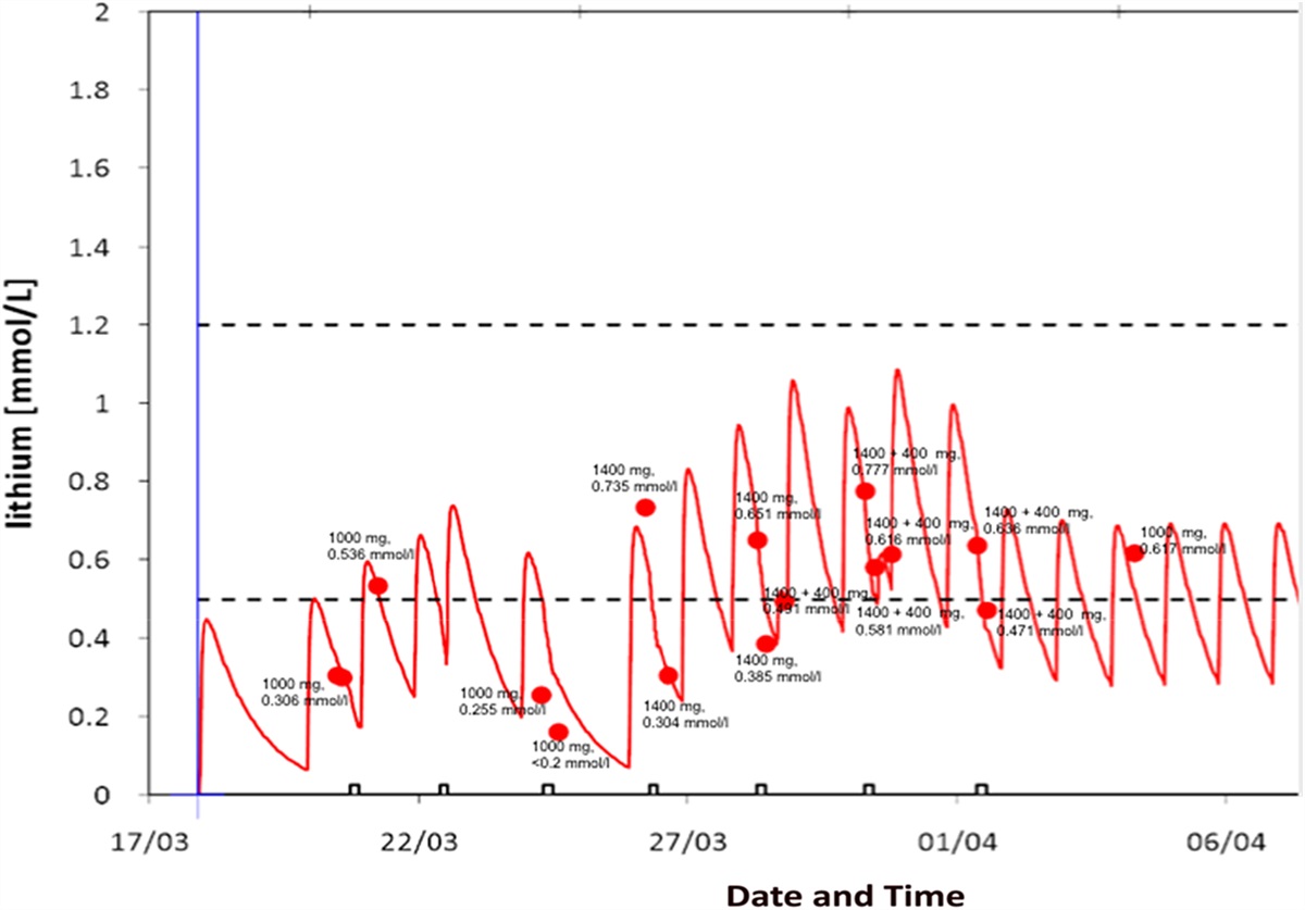 Effects of Plasmapheresis on Serum Lithium Levels in an ICU Patient with Bipolar Disorder: A Case Study