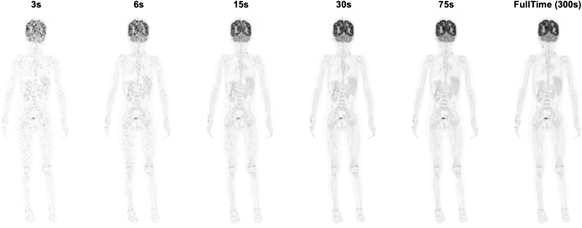 Intelligent ultrafast total-body PET for sedation-free pediatric [18F]FDG imaging