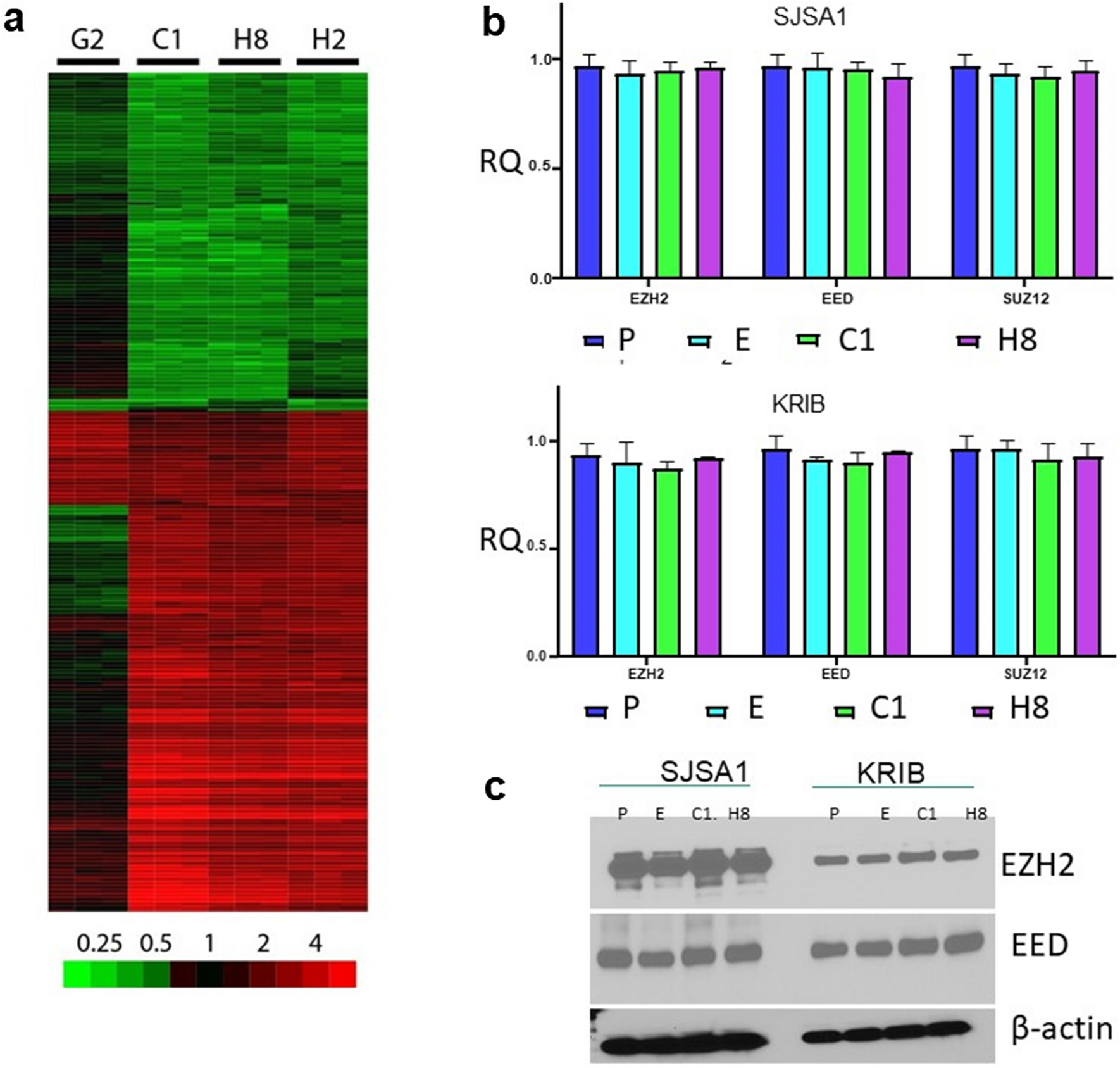 Targeting IL-11R/EZH2 signaling axis as a therapeutic strategy for osteosarcoma lung metastases