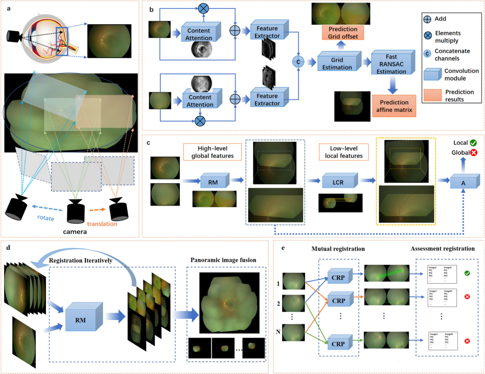 RDLR: A Robust Deep Learning-Based Image Registration Method for Pediatric Retinal Images