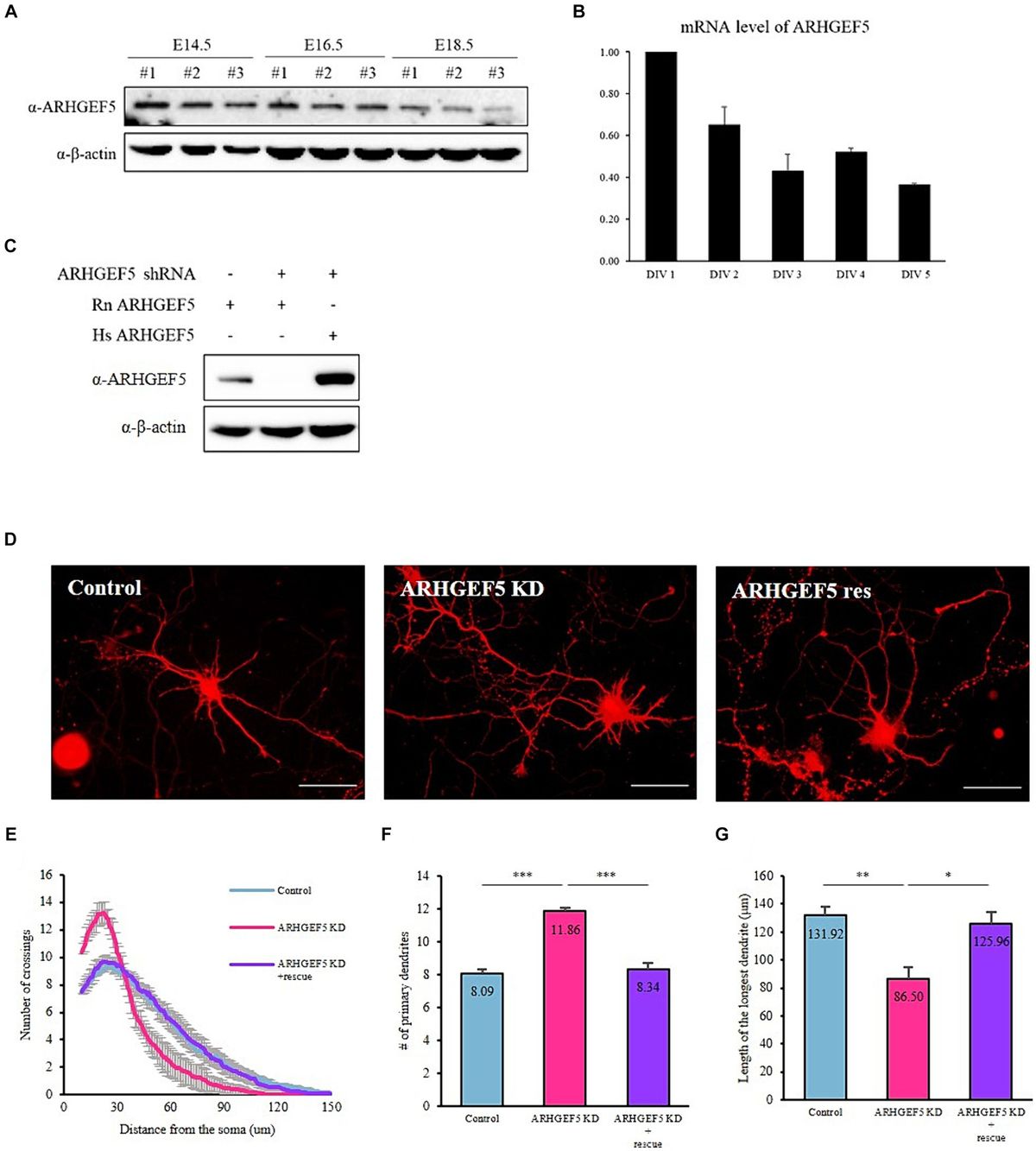 ARHGEF5 binds Drebrin and affects α-tubulin acetylation to direct neuronal morphogenesis and migration during mouse brain development