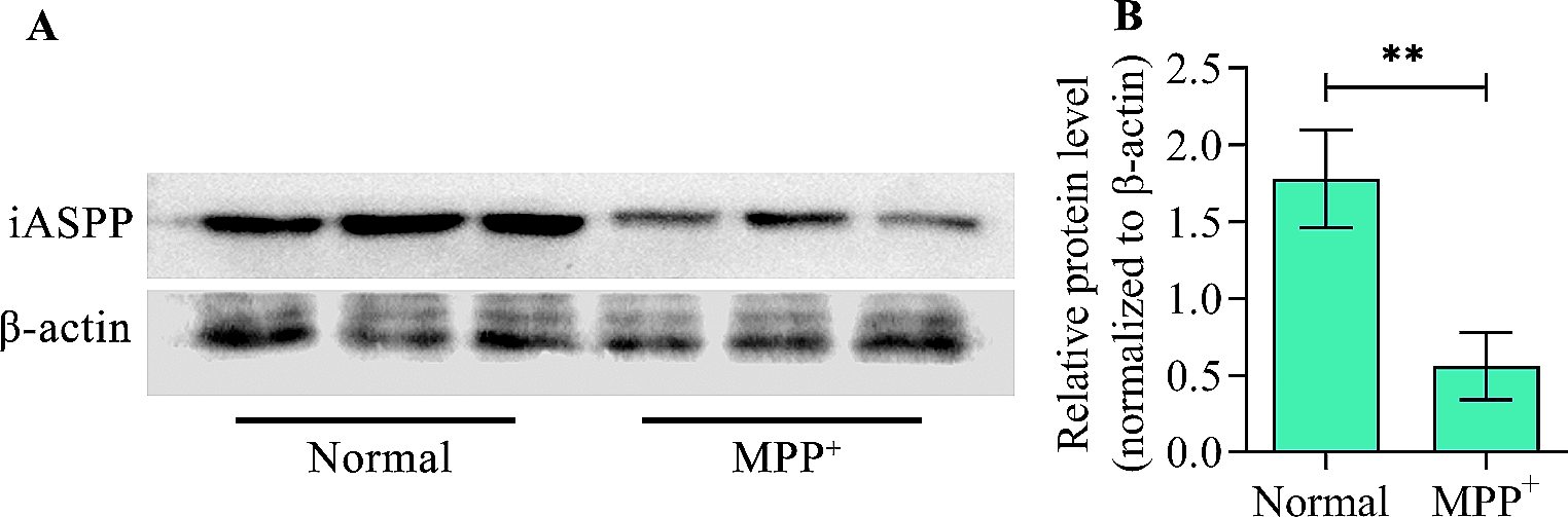 Inhibitor of apoptosis stimulating protein of p53 protects against MPP+-induced neurotoxicity of dopaminergic neurons