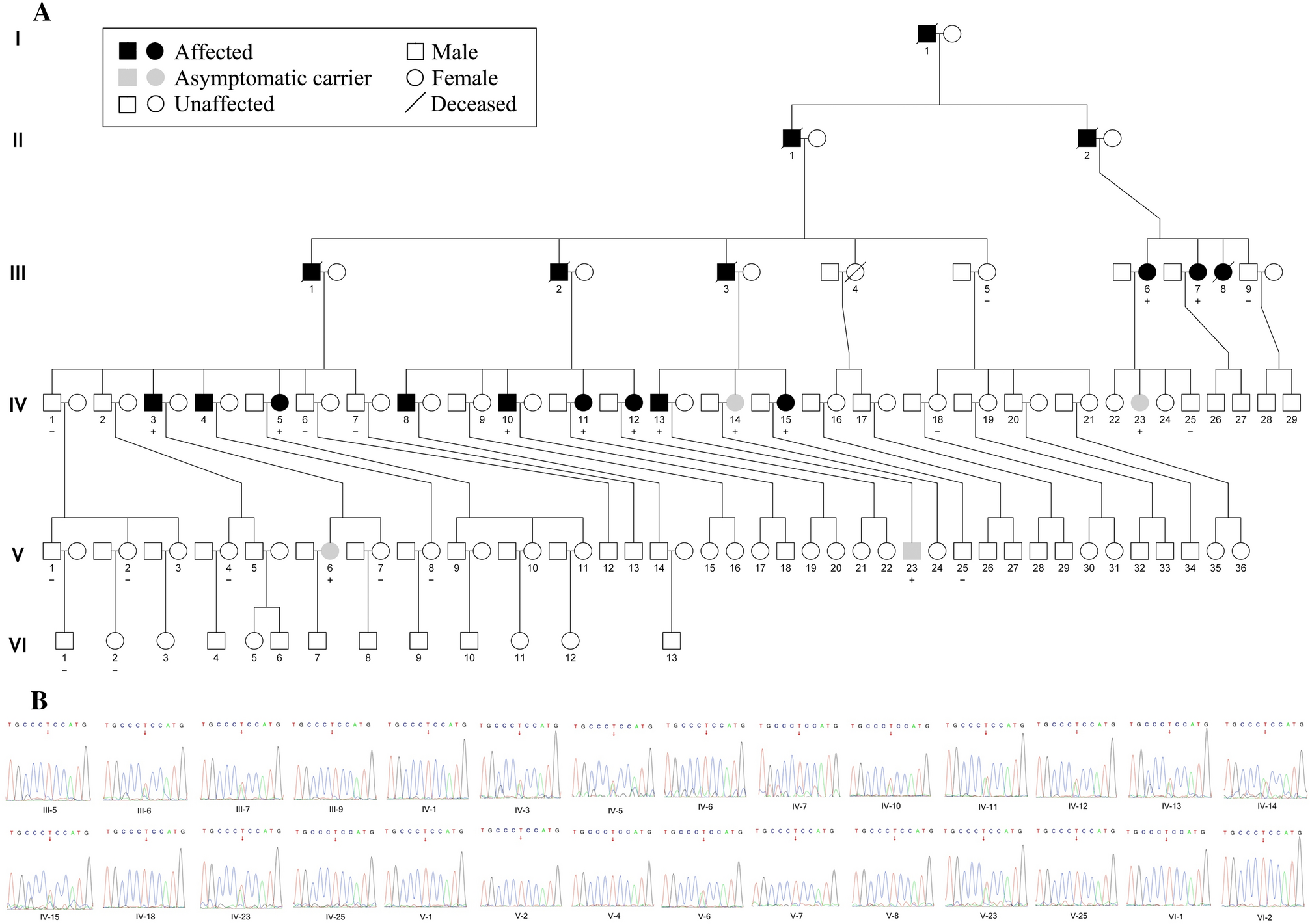 A Cysteinyl-tRNA Synthetase Mutation Causes Novel Autosomal-Dominant Inheritance of a Parkinsonism/Spinocerebellar-Ataxia Complex