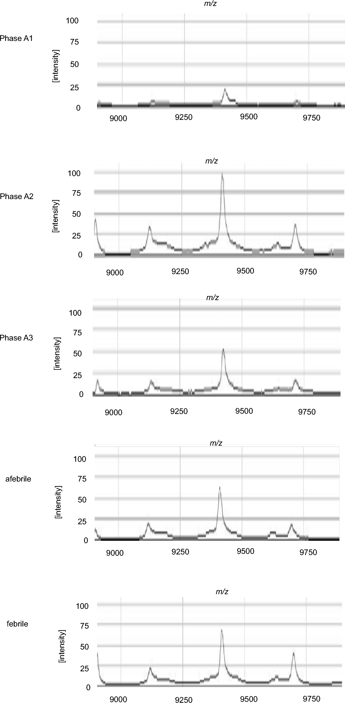 Decreased Serum Apolipoprotein CIII in the Acute Phase of Kawasaki Disease