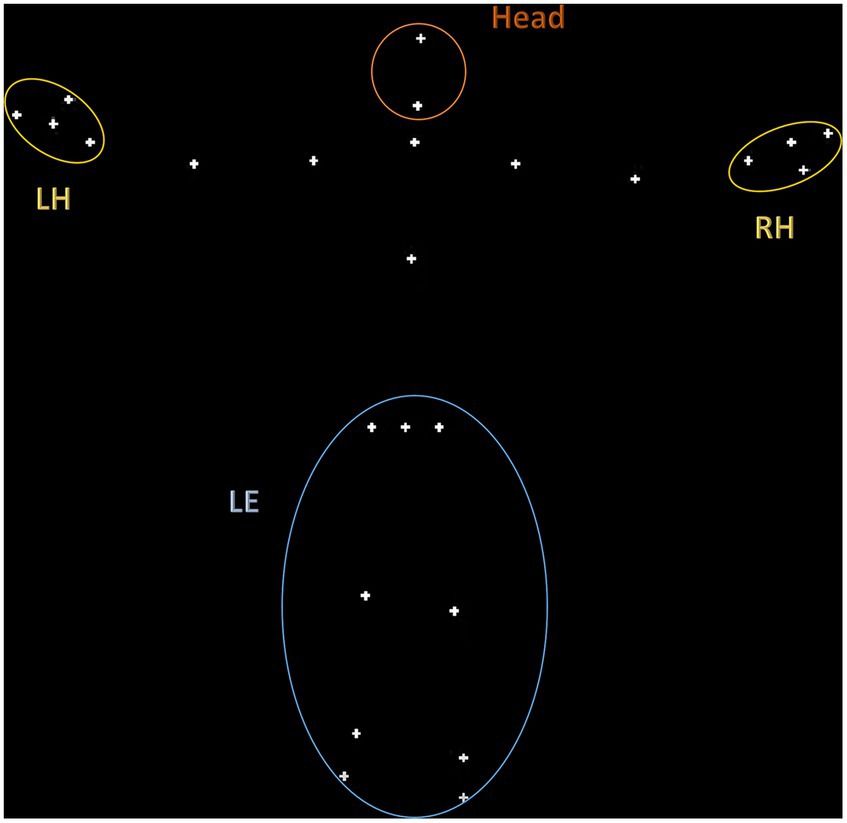 Level of autistic traits in neurotypical adults predicts kinematic idiosyncrasies in their biological movements