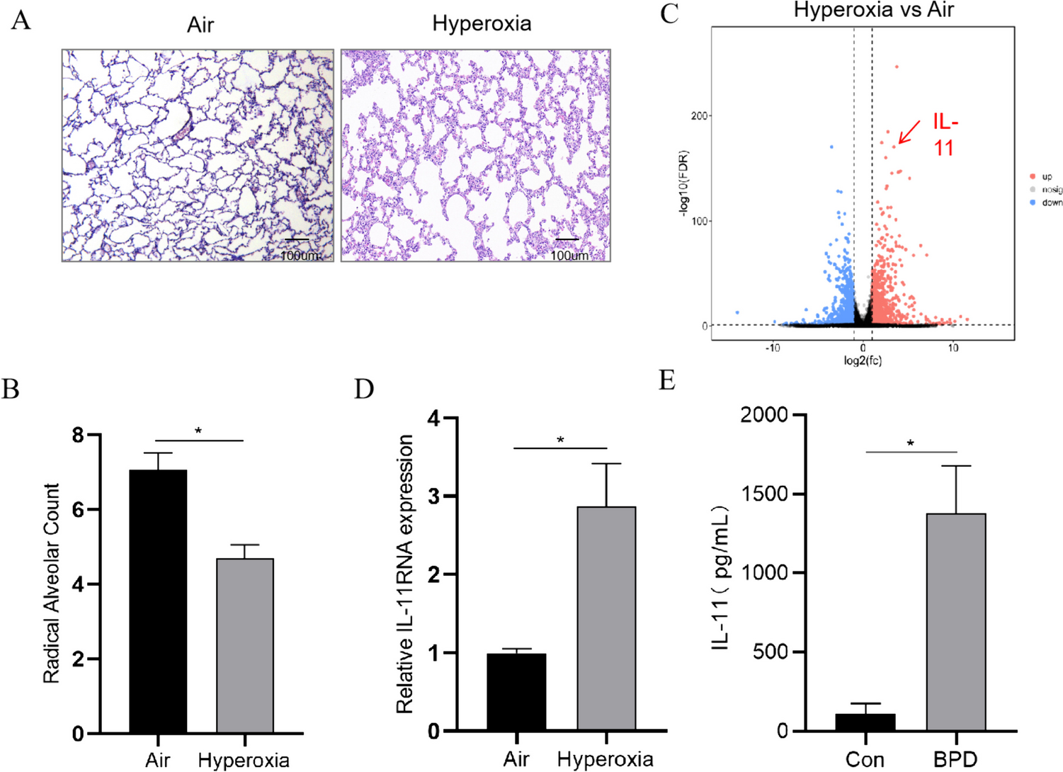 Interleukin-11 Is Involved in Hyperoxia-induced Bronchopulmonary Dysplasia in Newborn Mice by Mediating Epithelium-Fibroblast Cross-talk