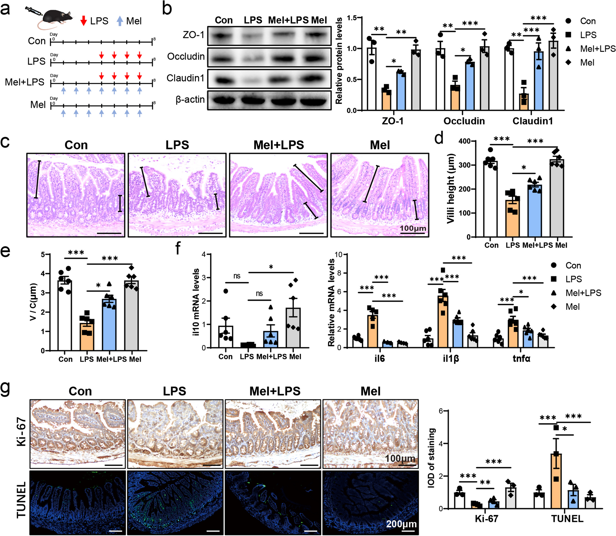 Melatonin via MTNR1B regulates METTL3 to protect ileum cell differentiation