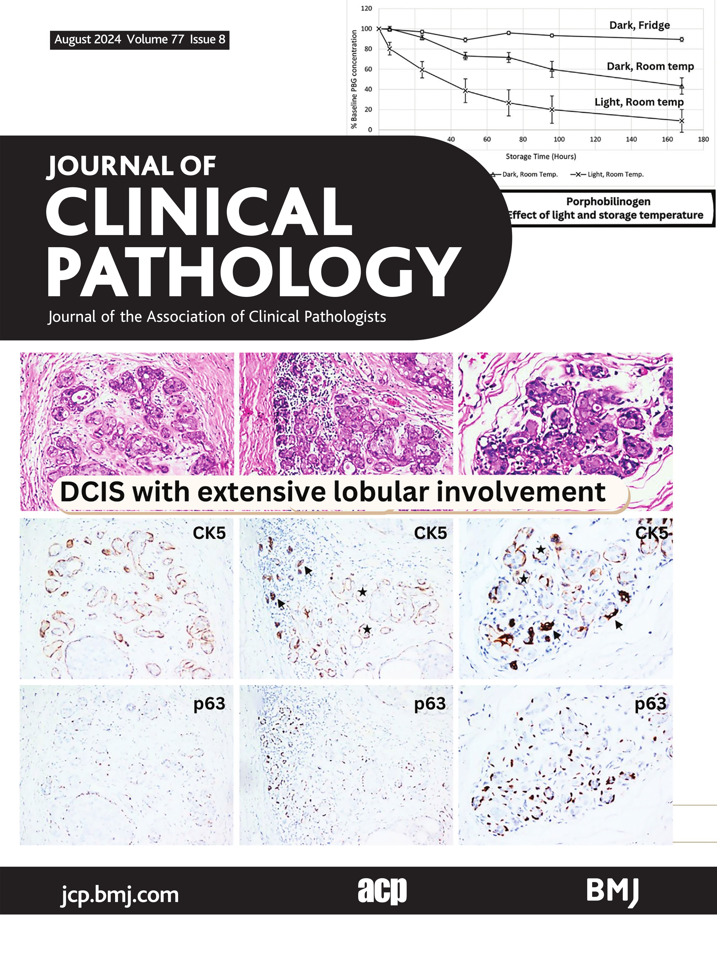 Stability of porphyrins and porphyrin precursors in urine and plasma samples: implications for sample handling and storage