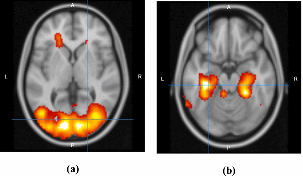 The Mind’s Eye is Not a Metaphor: Visuospatial Working Memory and Mental Imageries for Learning and Language Comprehension