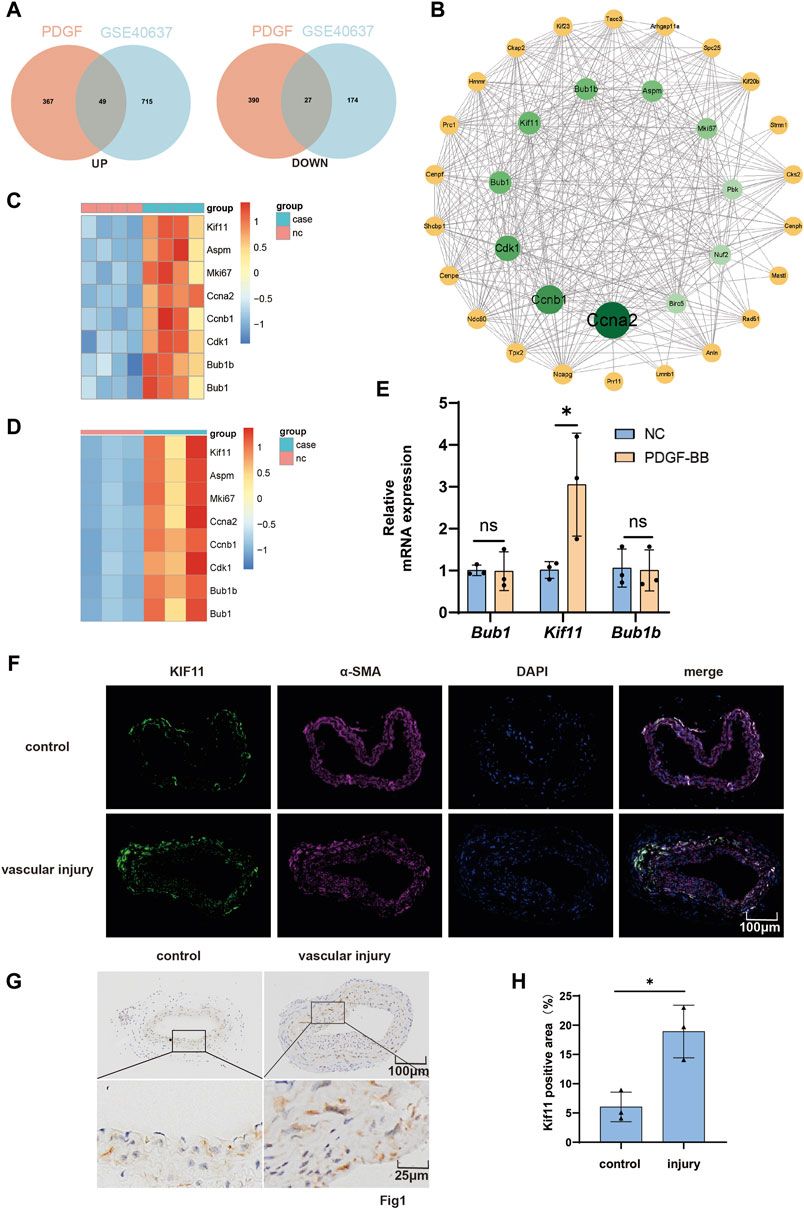 KIF11 promotes vascular smooth muscle cell proliferation by regulating cell cycle progression and accelerates neointimal formation after arterial injury in mice