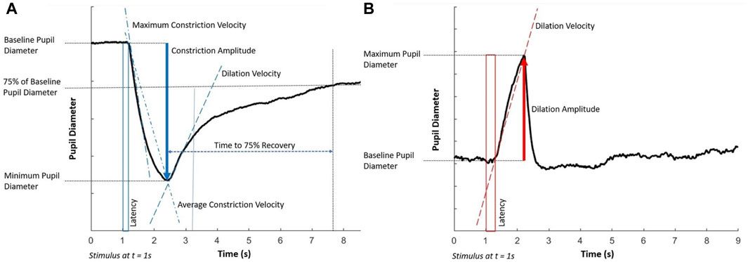 Characterising cerebrovascular reactivity and the pupillary light response–a comparative study