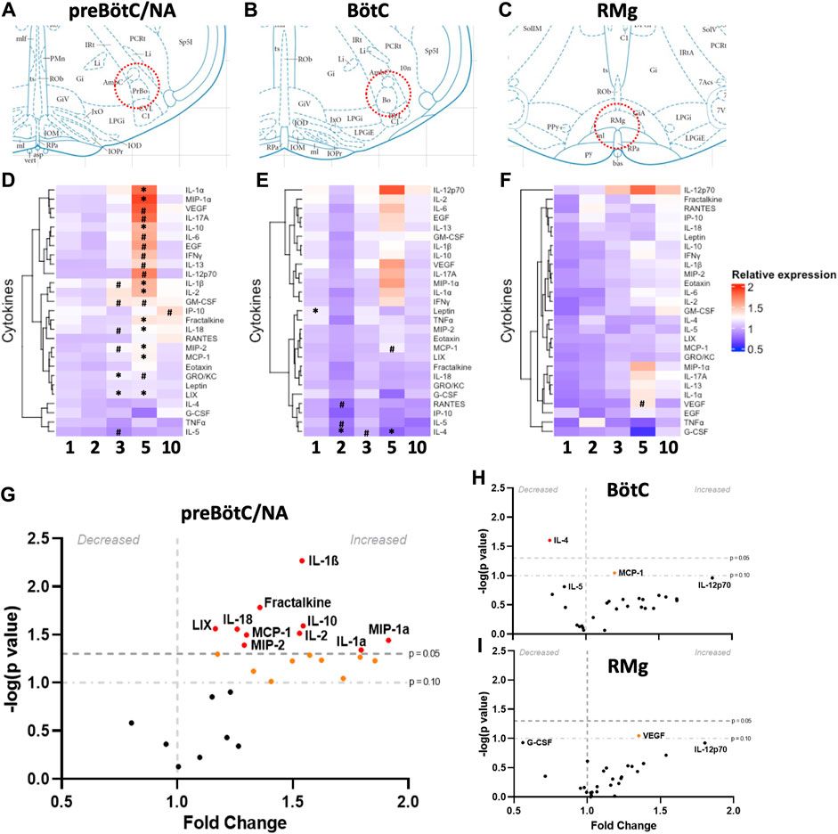 Repeated seizure-induced brainstem neuroinflammation contributes to post-ictal ventilatory control dysfunction