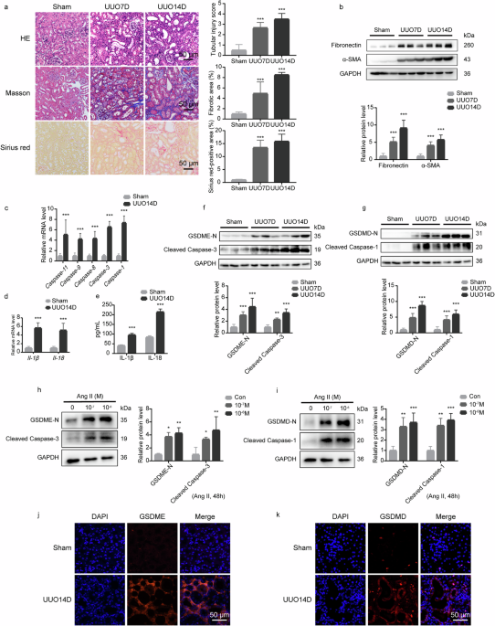 USP11 promotes renal tubular cell pyroptosis and fibrosis in UUO mice via inhibiting KLF4 ubiquitin degradation