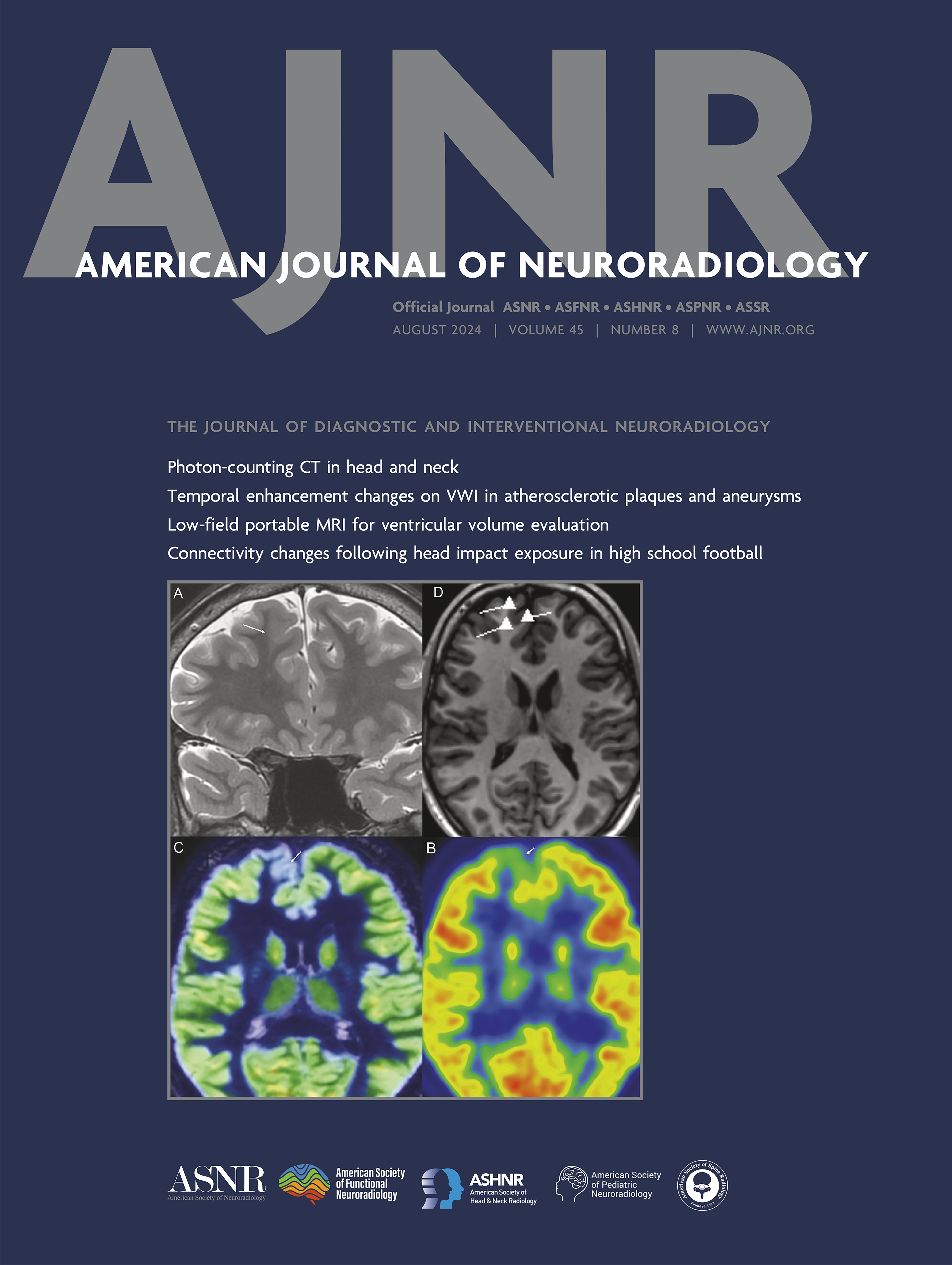 Deposition of Gadolinium in the Central and Peripheral Nervous Systems and Its Effects on Sensory, Cognitive, and Athletic Implications after Multiple Injections of Gadolinium-Based Contrast Agents in Rats [NEUROPSYCHIATRIC IMAGING]