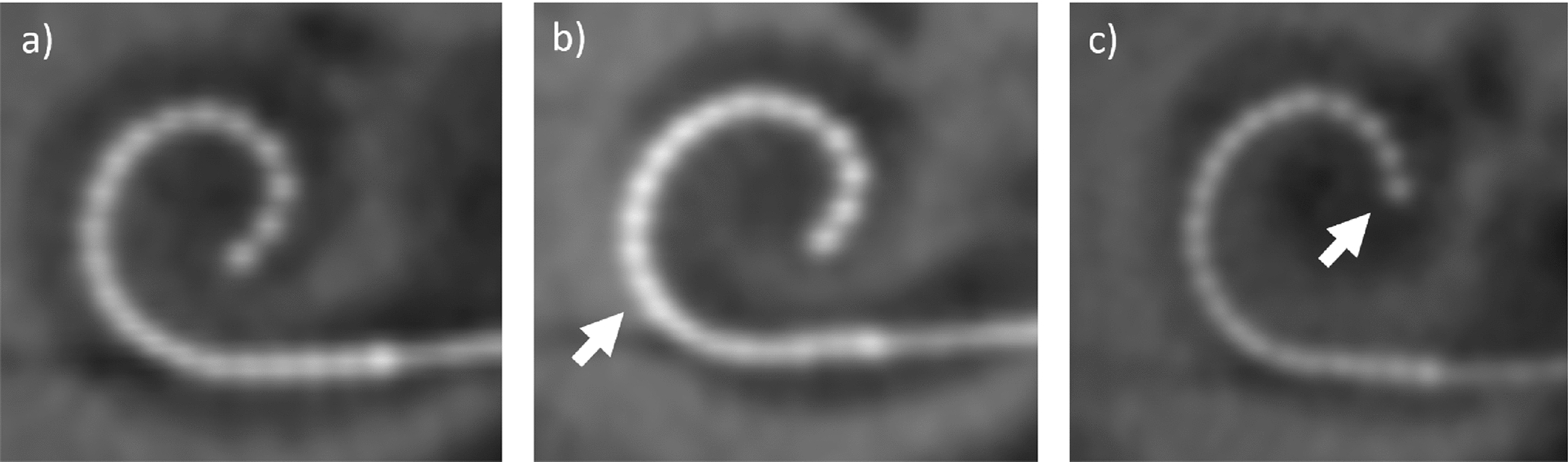 Curvature analysis of CI electrode arrays: a novel approach to categorize perimodiolar positions without anatomical landmarks