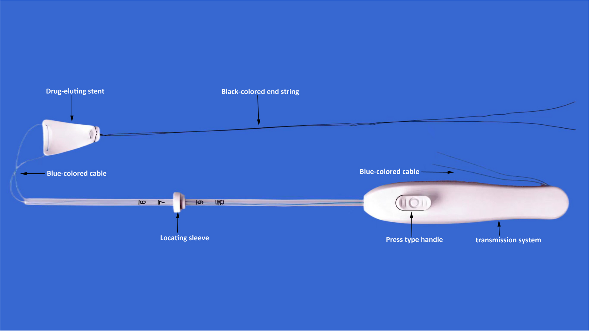 A novel intrauterine estrogen-releasing system for preventing the postoperative recurrence of intrauterine adhesion: a multicenter randomized controlled study