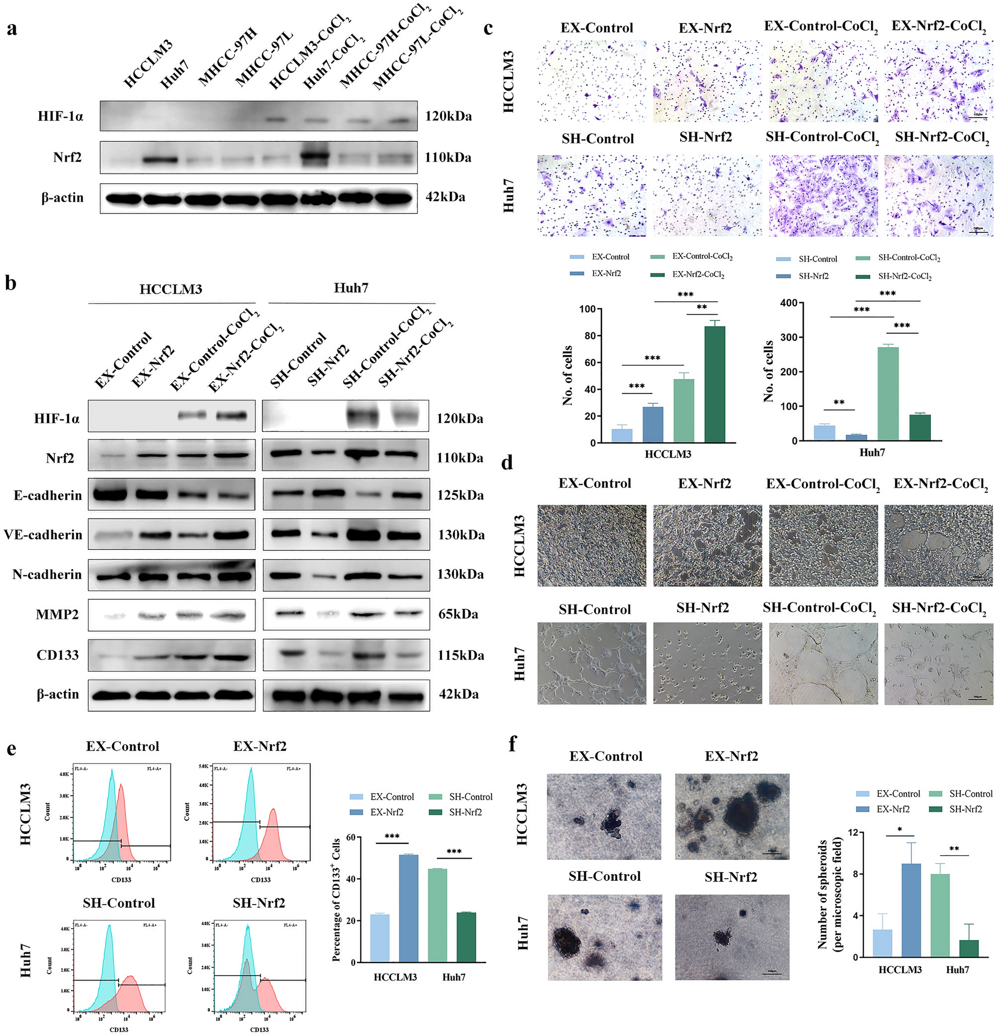 Nrf2/ASPM axis regulated vasculogenic mimicry formation in hepatocellular carcinoma under hypoxia