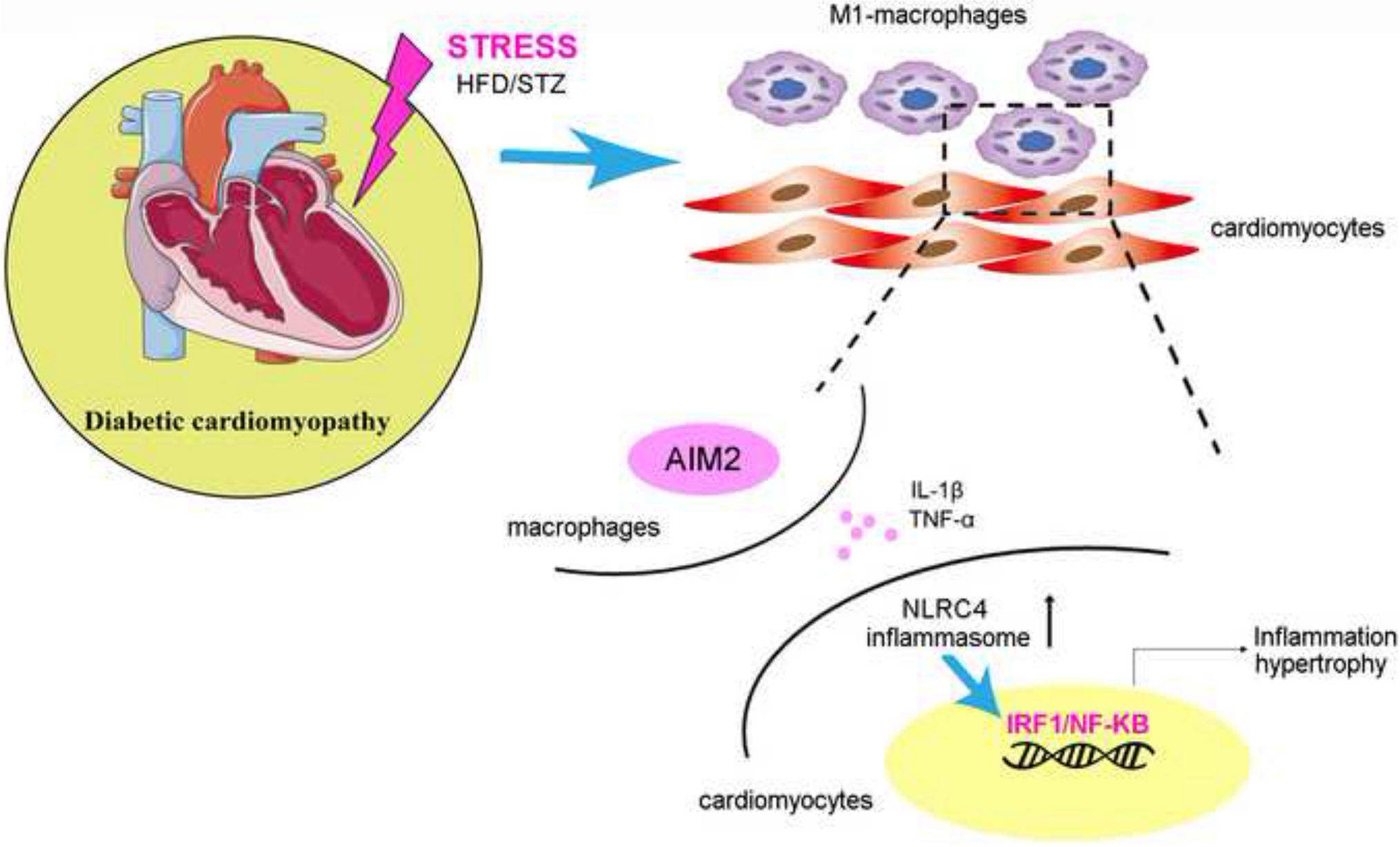 AIM2 Deficiency Alleviates Cardiac Inflammation and Hypertrophy in HFD/STZ-Induced Diabetic Mice by Inhibiting the NLRC4/IRF1 Signaling Pathway