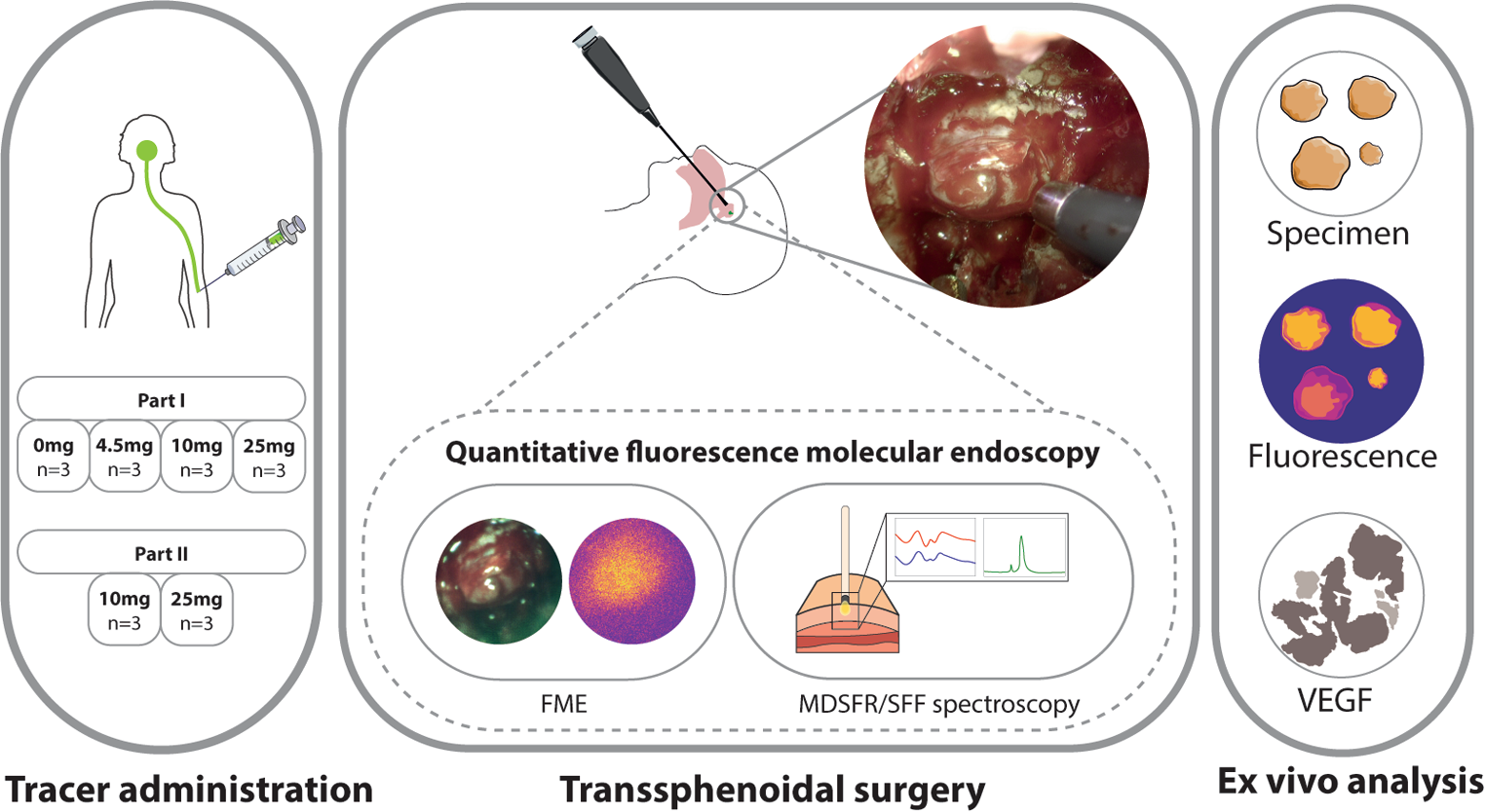 Fluorescence detection of pituitary neuroendocrine tumour during endoscopic transsphenoidal surgery using bevacizumab-800CW: a non-randomised, non-blinded, single centre feasibility and dose finding trial [DEPARTURE trial]