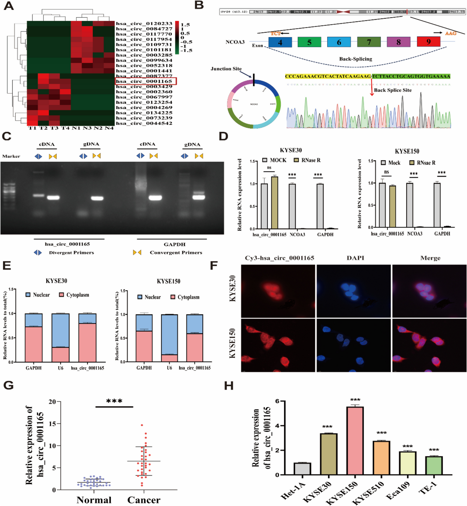 EIF4A3-mediated oncogenic circRNA hsa_circ_0001165 advances esophageal squamous cell carcinoma progression through the miR-381-3p/TNS3 pathway