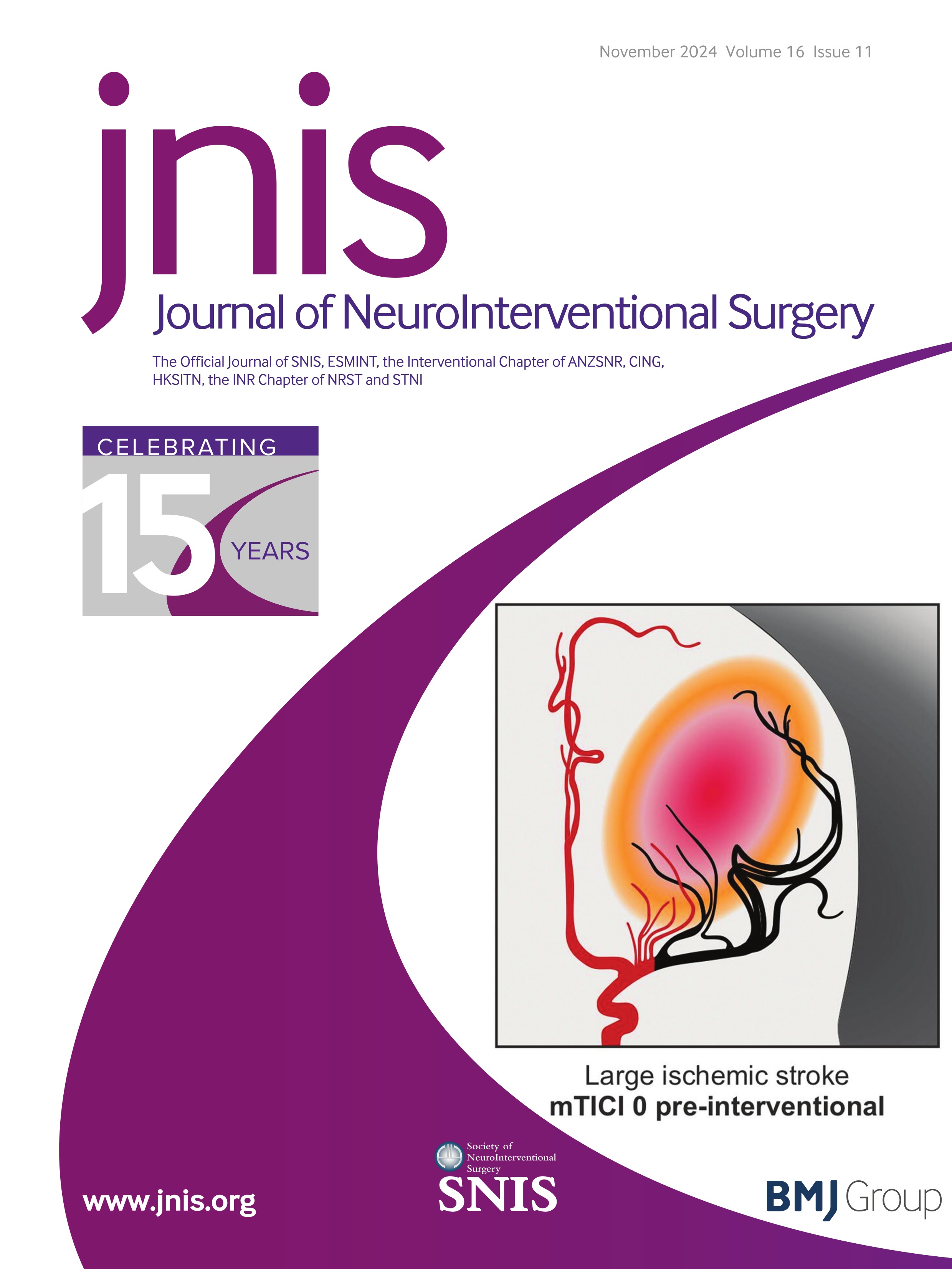 Comparison of Thrombolysis In Cerebral Infarction (TICI) 2b and TICI 3 reperfusion in endovascular therapy for large ischemic anterior circulation strokes