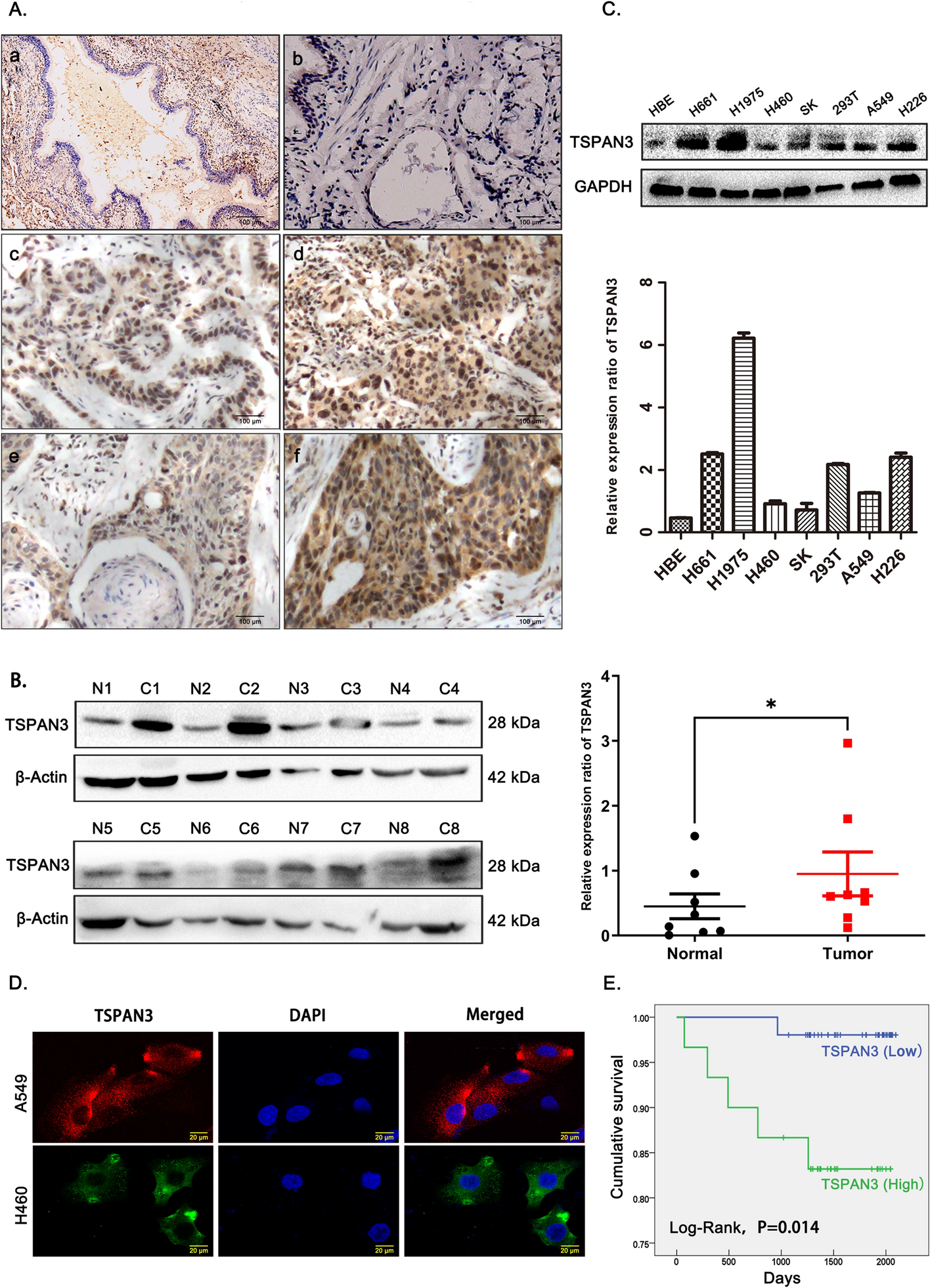 Tetraspanin 3 promotes NSCLC cell proliferation via regulation of β1 integrin intracellular recycling