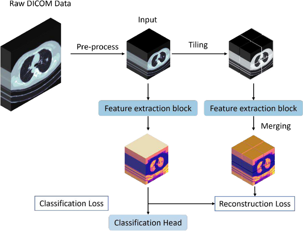 Prediction of Malignancy and Pathological Types of Solid Lung Nodules on CT Scans Using a Volumetric SWIN Transformer