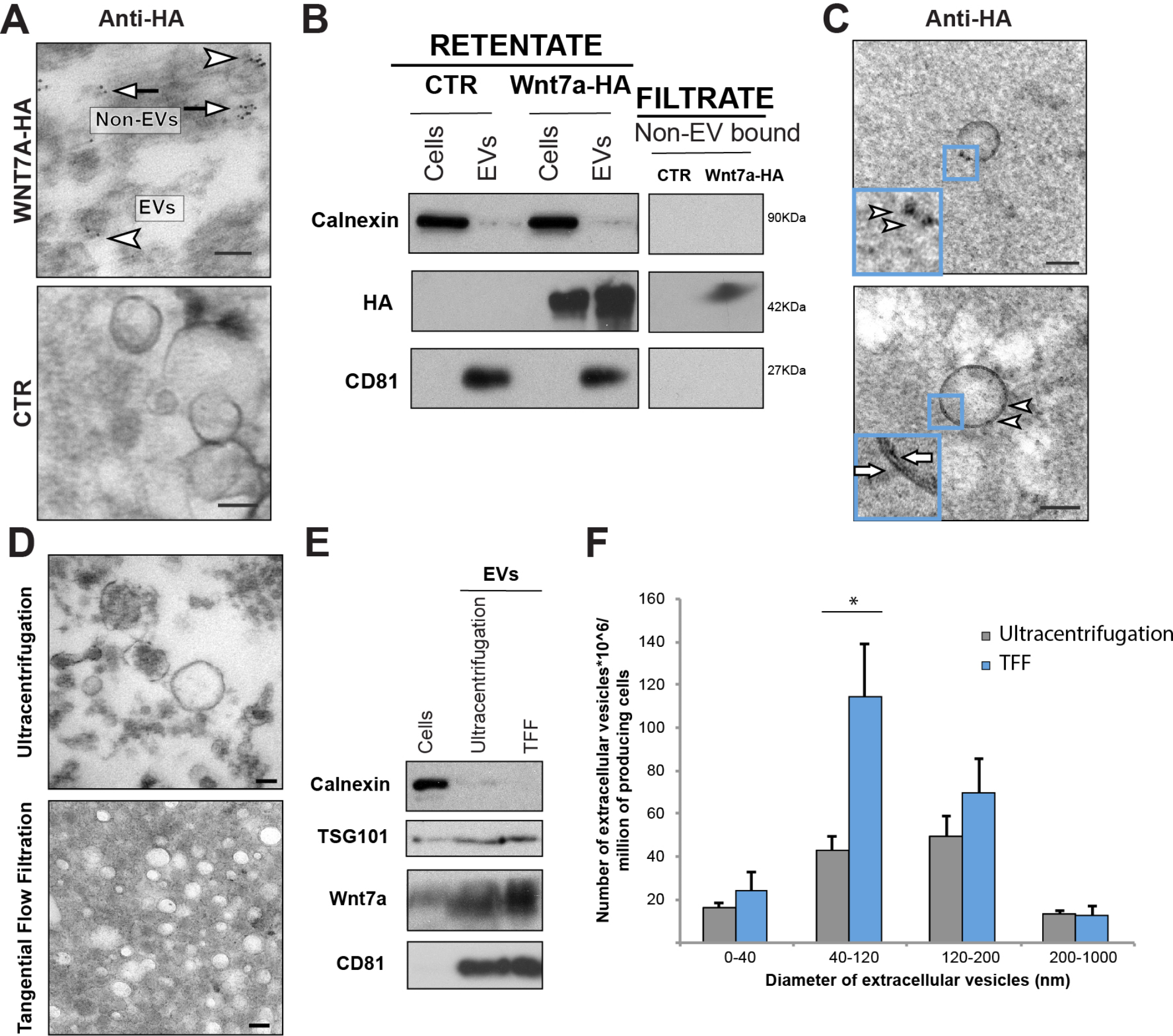 Isolation of small extracellular vesicles from regenerating muscle tissue using tangential flow filtration and size exclusion chromatography