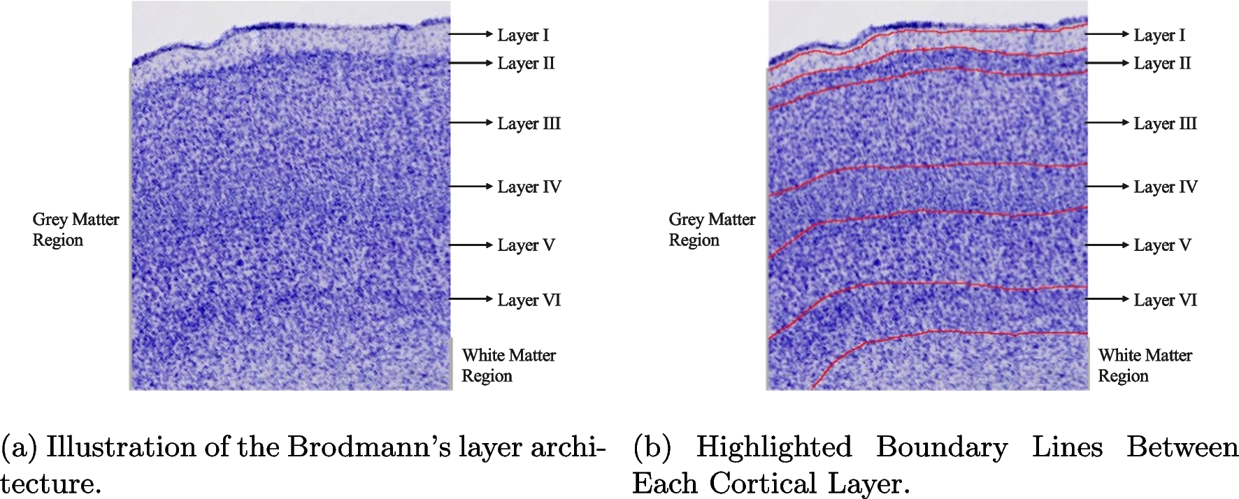 A Deep Learning-based Pipeline for Segmenting the Cerebral Cortex Laminar Structure in Histology Images