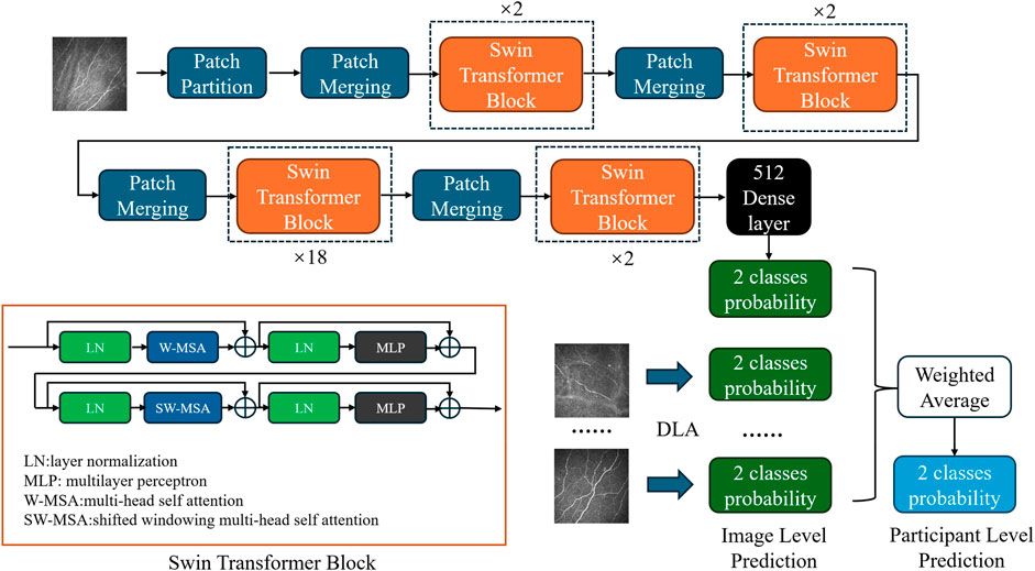 Development of a transformer-based deep learning algorithm for diabetic peripheral neuropathy classification using corneal confocal microscopy images