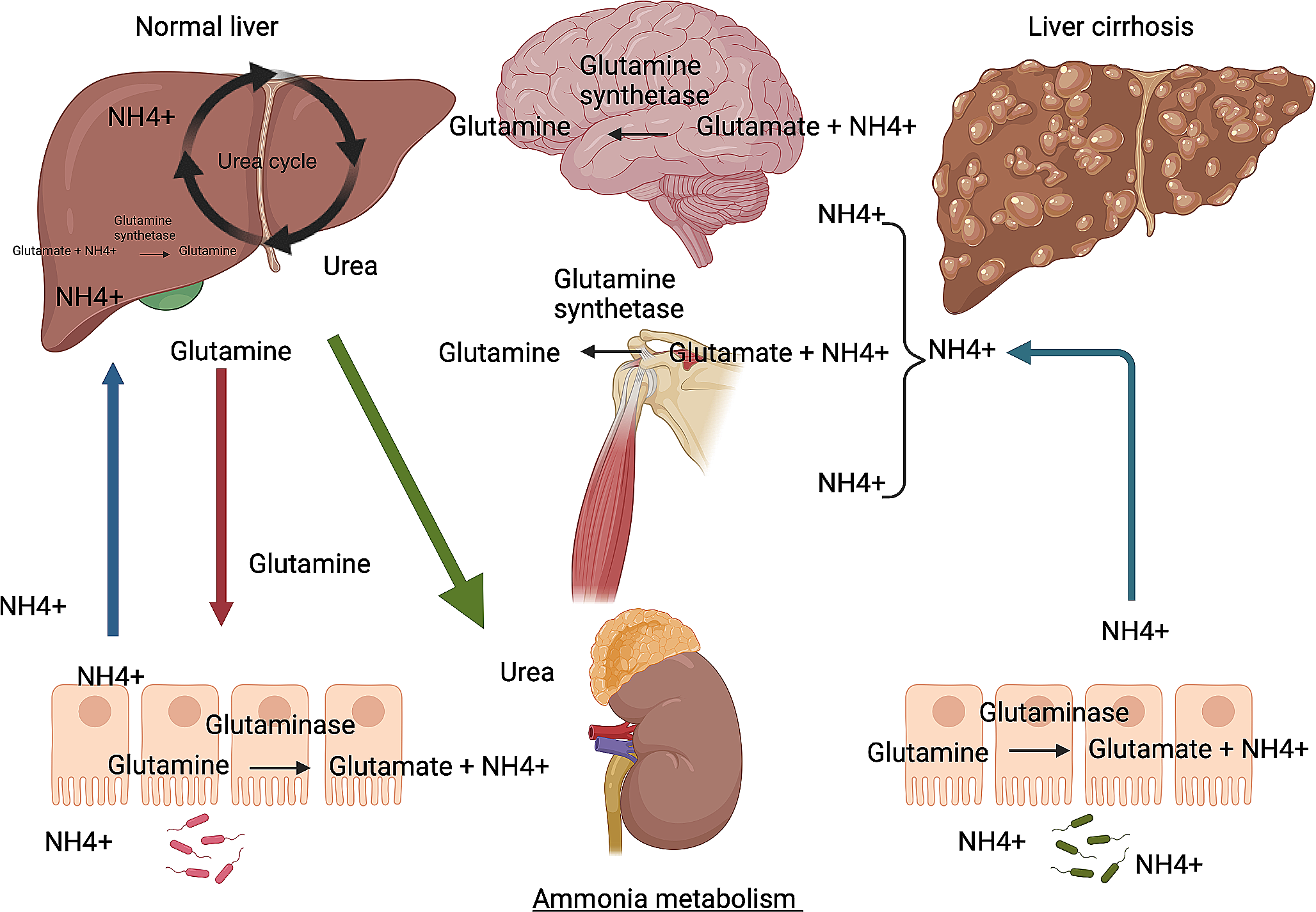 Infection, inflammation and hepatic encephalopathy from a clinical perspective