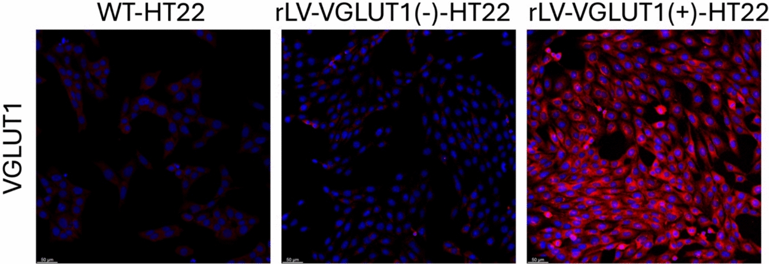 Neuroprotective Effects of VGLUT1 Inhibition in HT22 Cells Overexpressing VGLUT1 Under Oxygen Glucose Deprivation Conditions