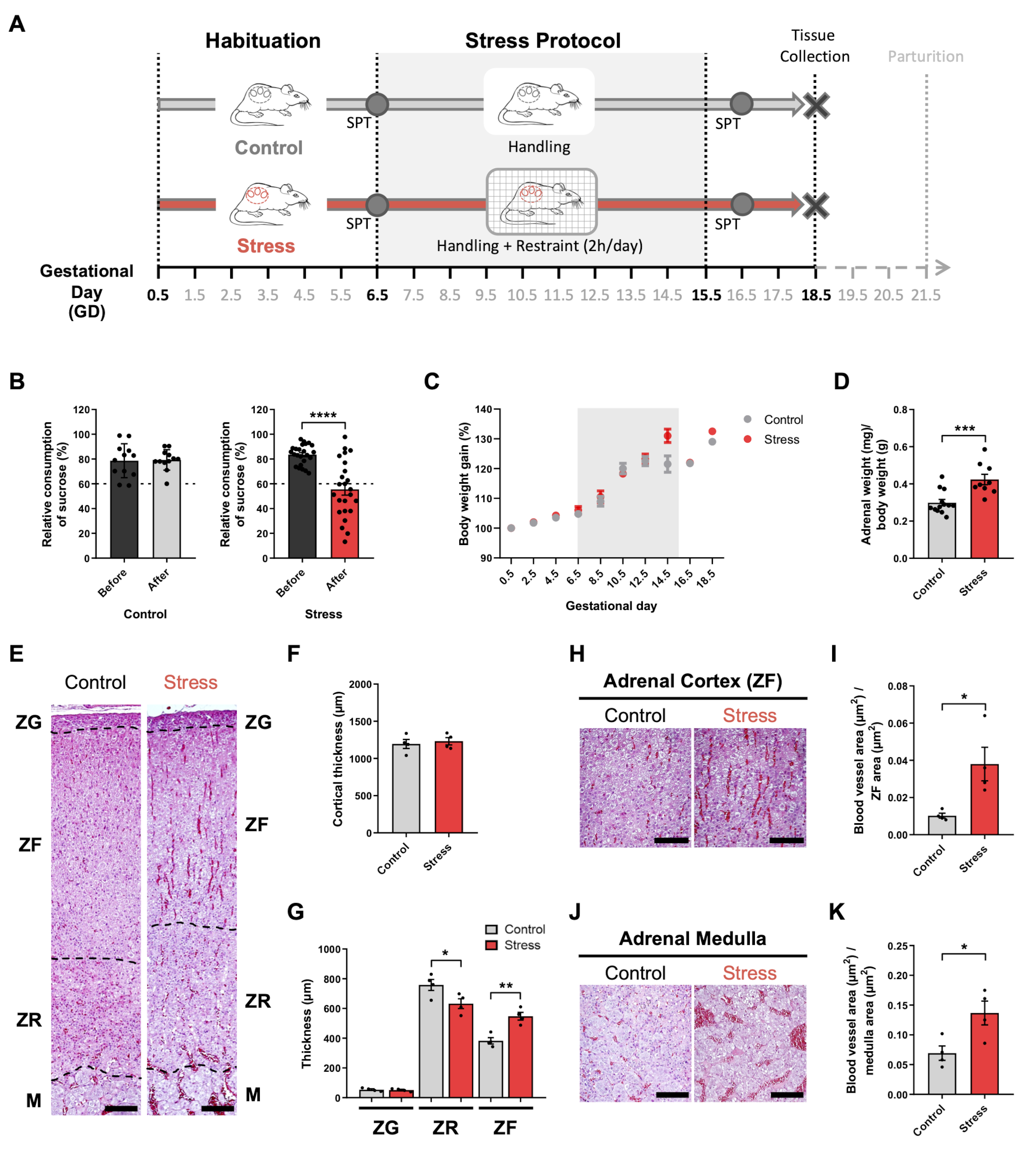 Maternal stress during pregnancy alters circulating small extracellular vesicles and enhances their targeting to the placenta and fetus