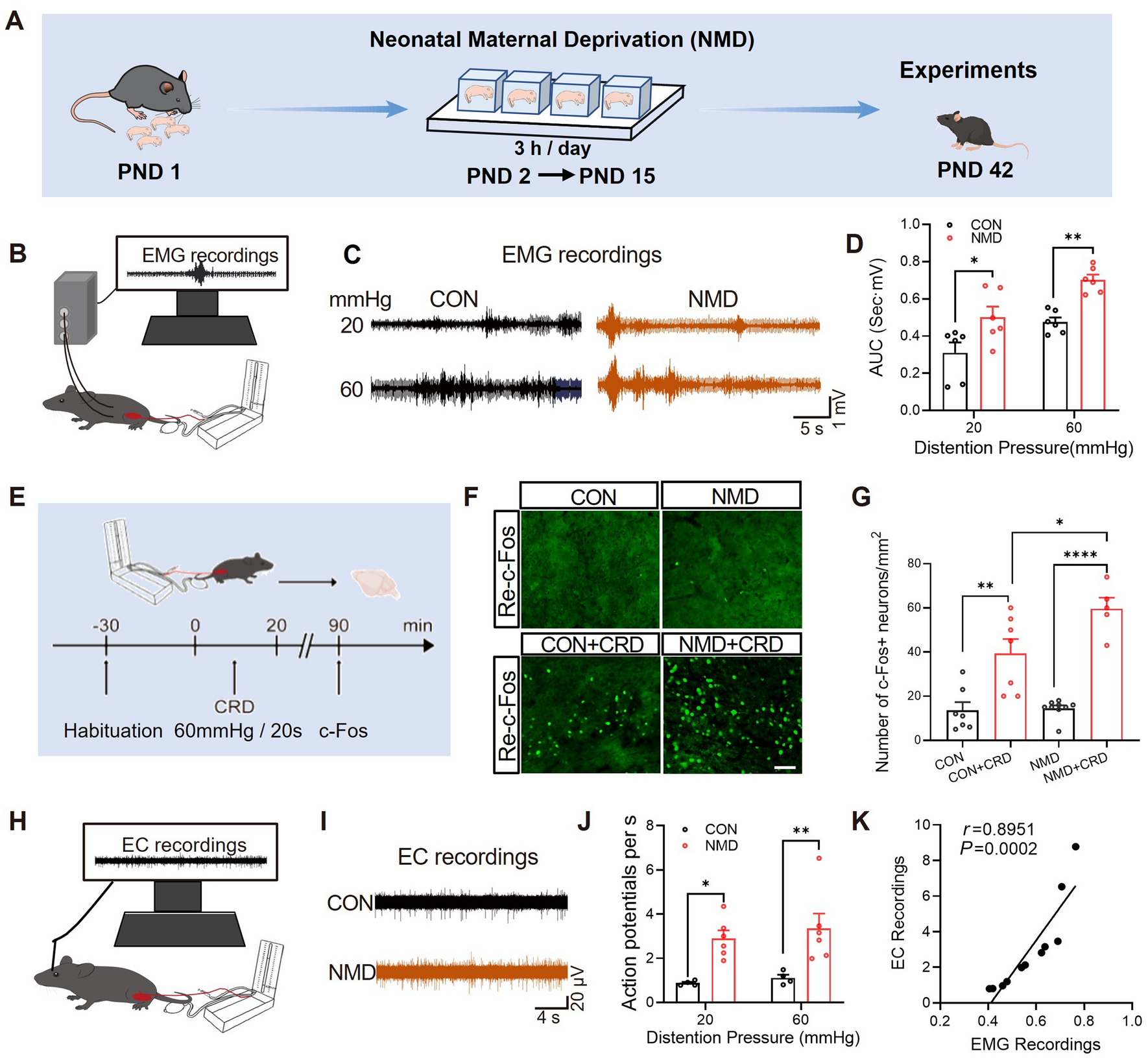 Thalamic Nucleus Reuniens Glutamatergic Neurons Mediate Colorectal Visceral Pain in Mice via 5-HT2B Receptors