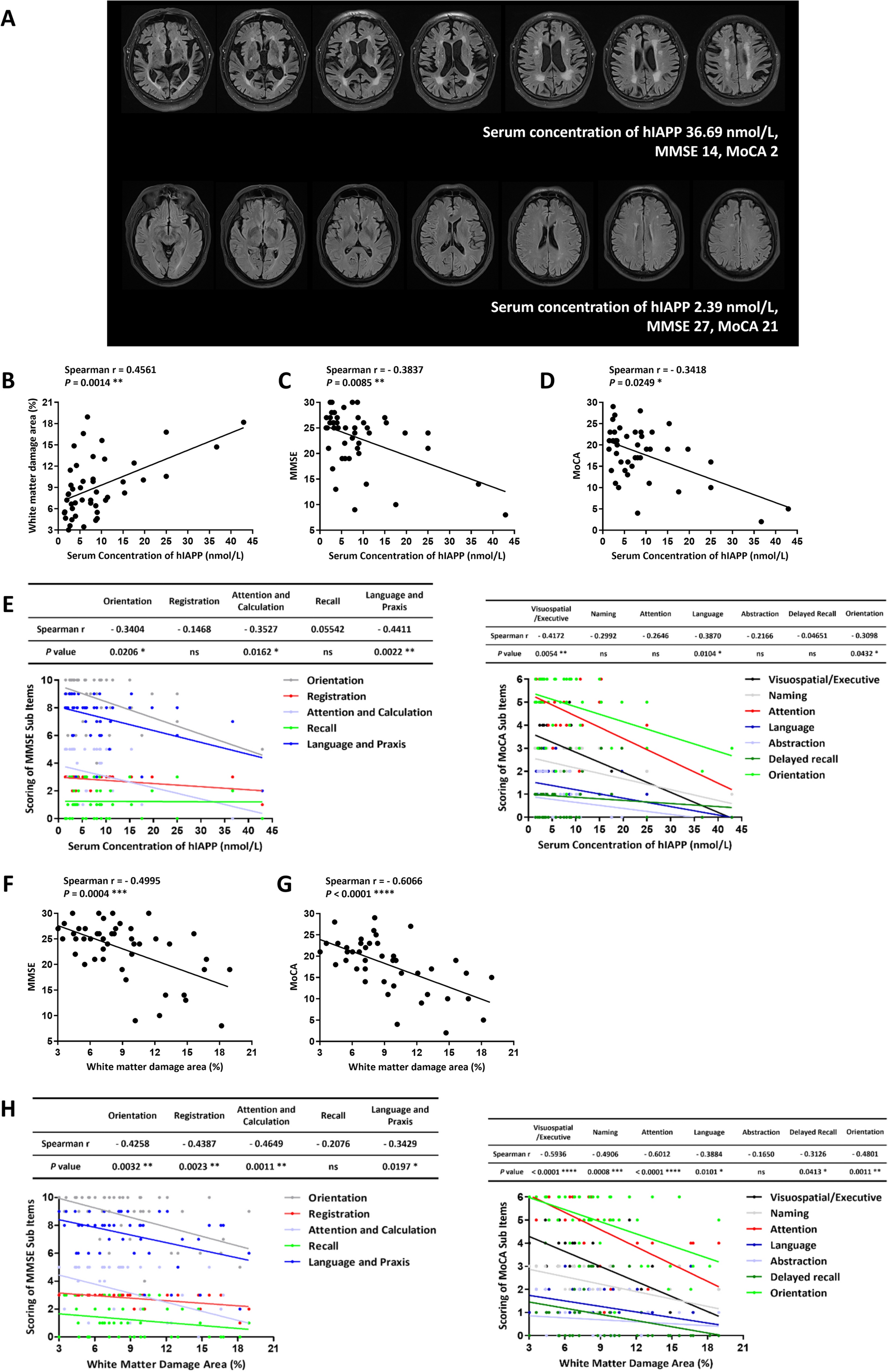 Inhibition of YIPF2 Improves the Vulnerability of Oligodendrocytes to Human Islet Amyloid Polypeptide