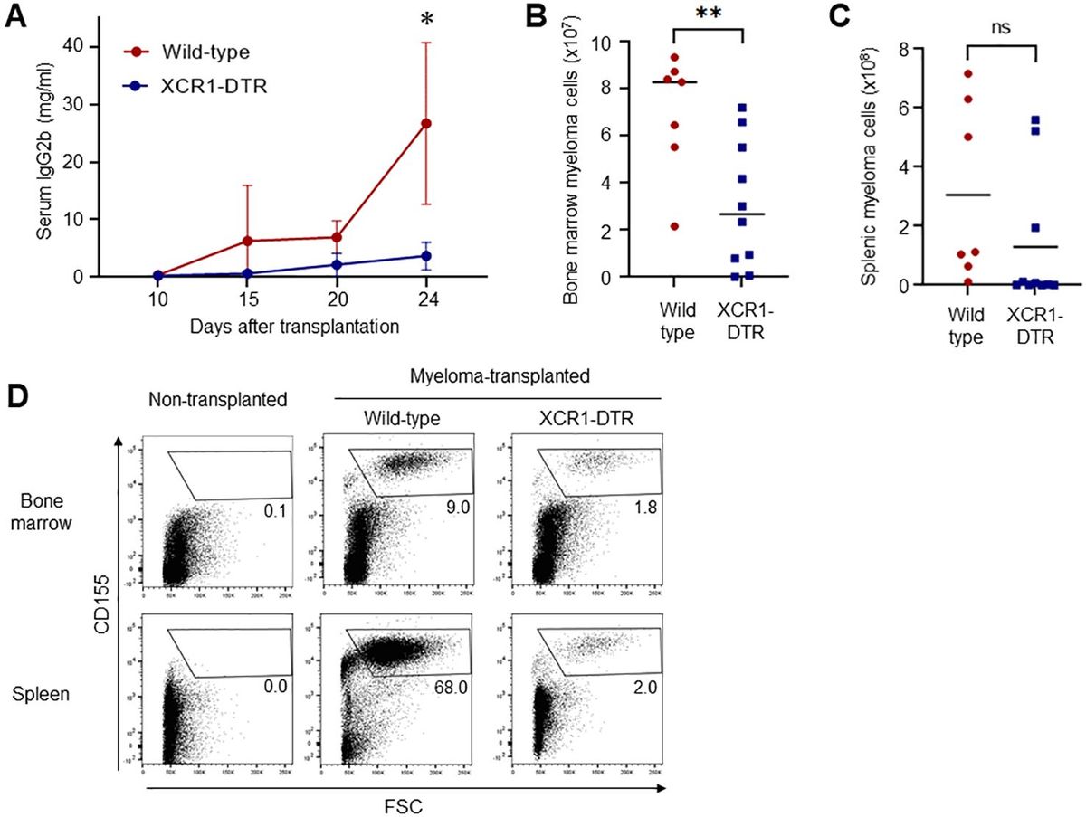 Type I-conventional dendritic cells support the progression of multiple myeloma in the bone marrow