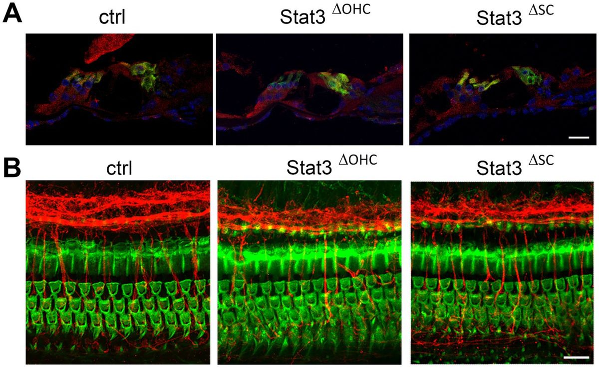 Inactivity of Stat3 in sensory and non-sensory cells of the mature cochlea