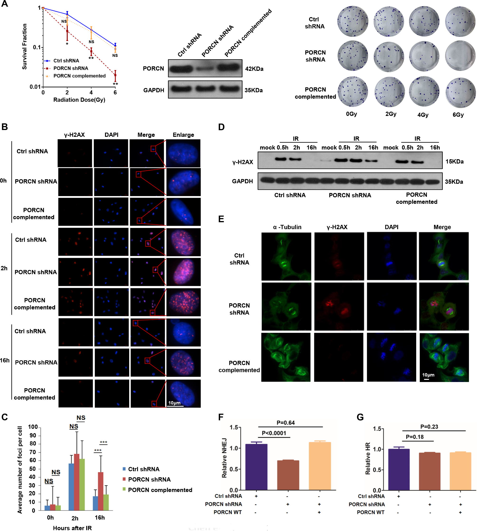 Nuclear porcupine mediates XRCC6/Ku70 S-palmitoylation in the DNA damage response