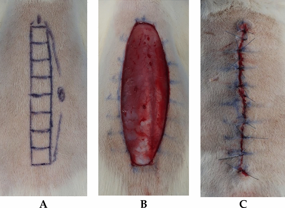 Zinc-Alpha-2-Glycoprotein Peptide Downregulates Type I and III Collagen Expression via Suppression of TGF-β and p-Smad 2/3 Pathway in Keloid Fibroblasts and Rat Incisional Model