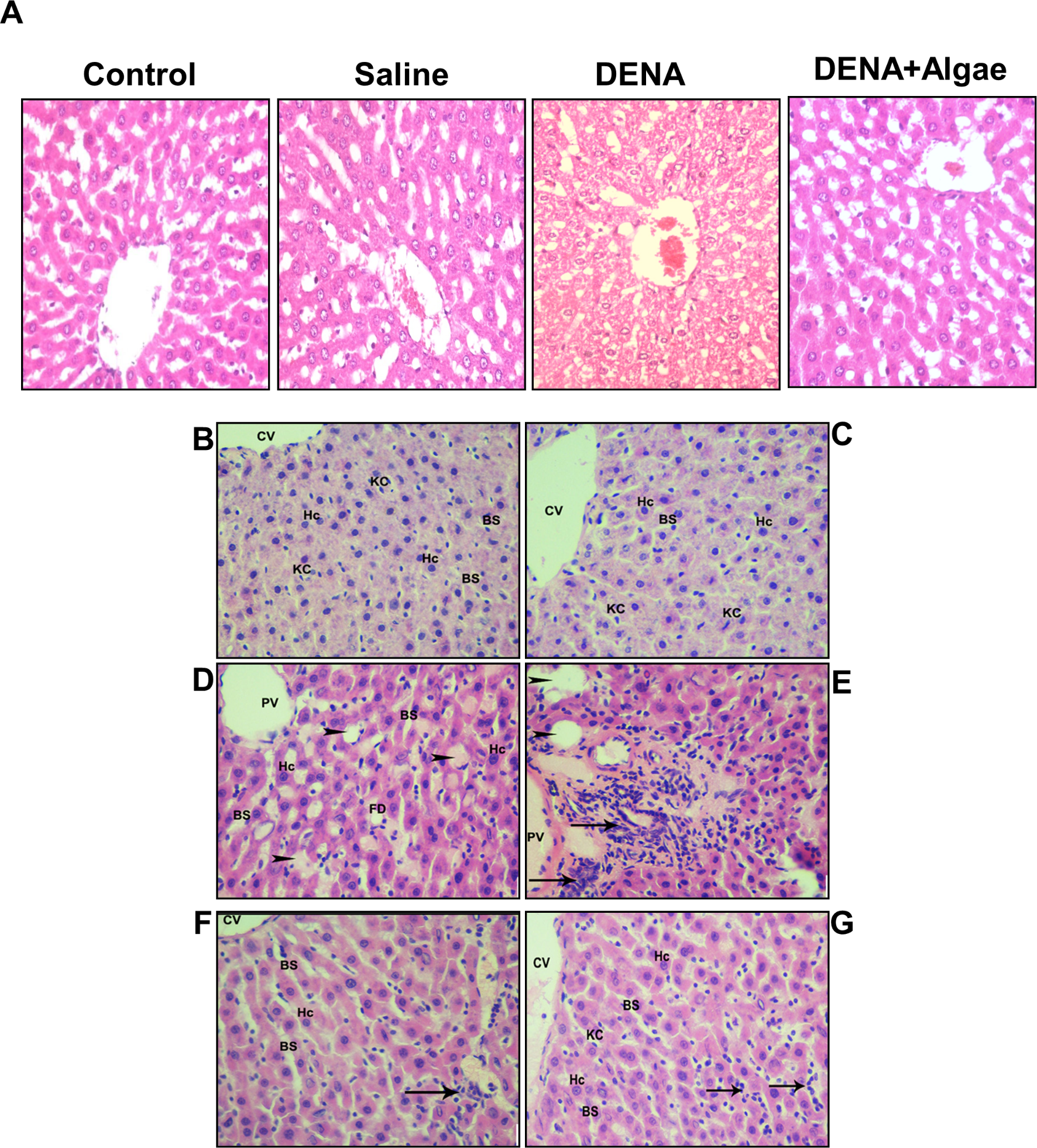 Ameliorative effects of Turbinaria ornata extract on hepatocellular carcinoma induced by diethylnitrosamine in-vivo