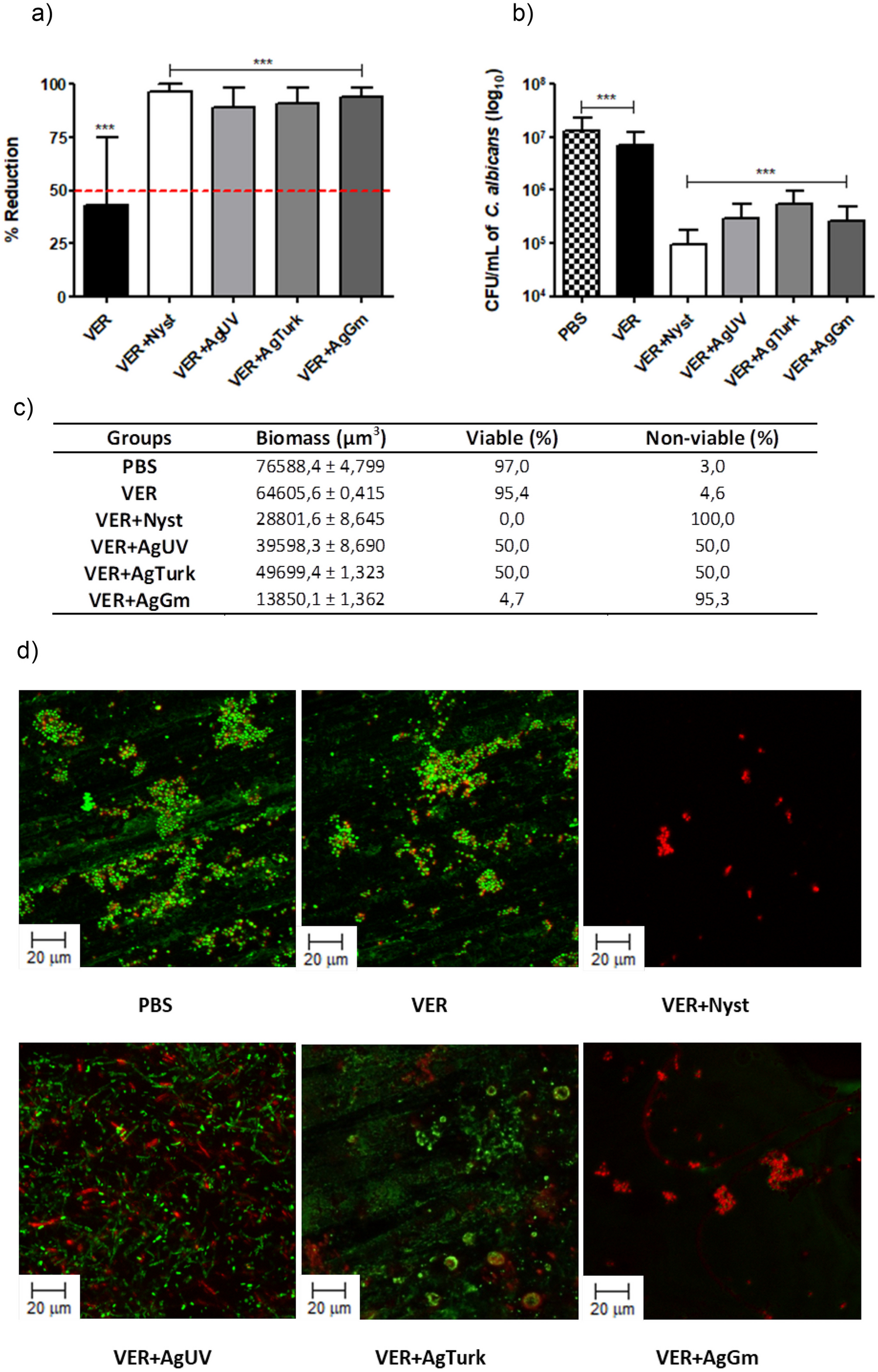 Anti-Candida activity and biocompatibility of silver nanoparticles associated with denture glaze: a new approach to the management of denture stomatitis