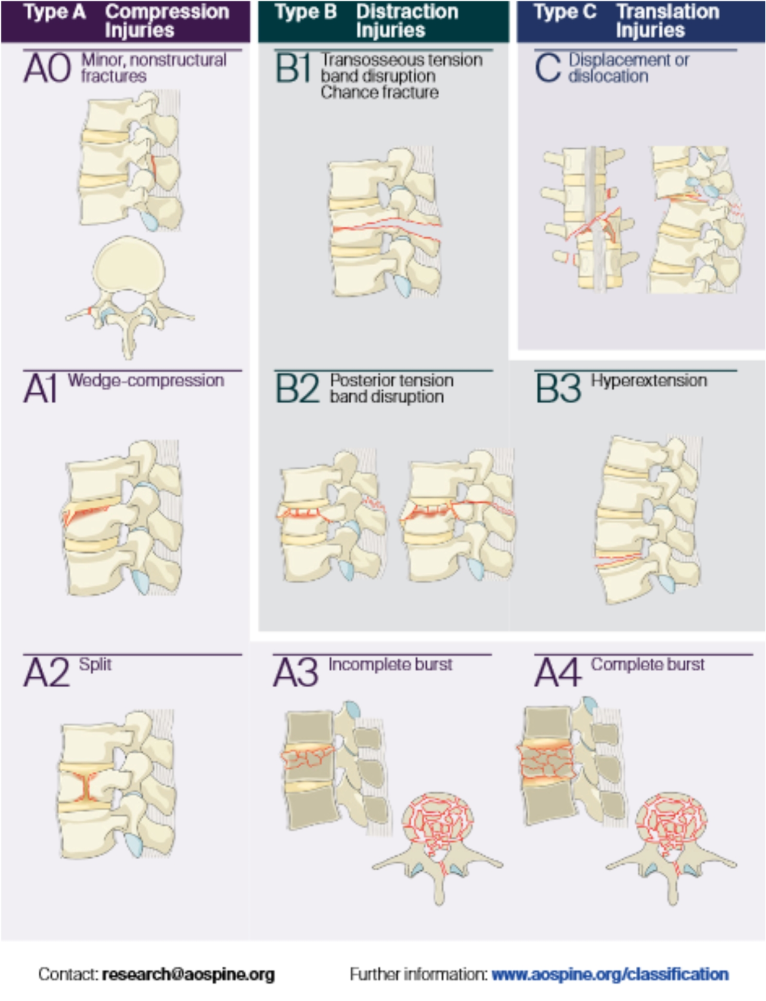 Thoracolumbar injuries: prehospital and emergency management, imaging, classifications and clinical implications