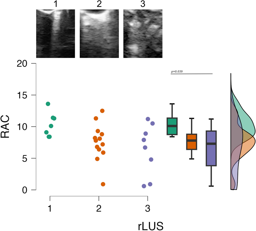 Quantitative lung ultrasound findings correlate with radial alveolar count in experimental bronchopulmonary dysplasia