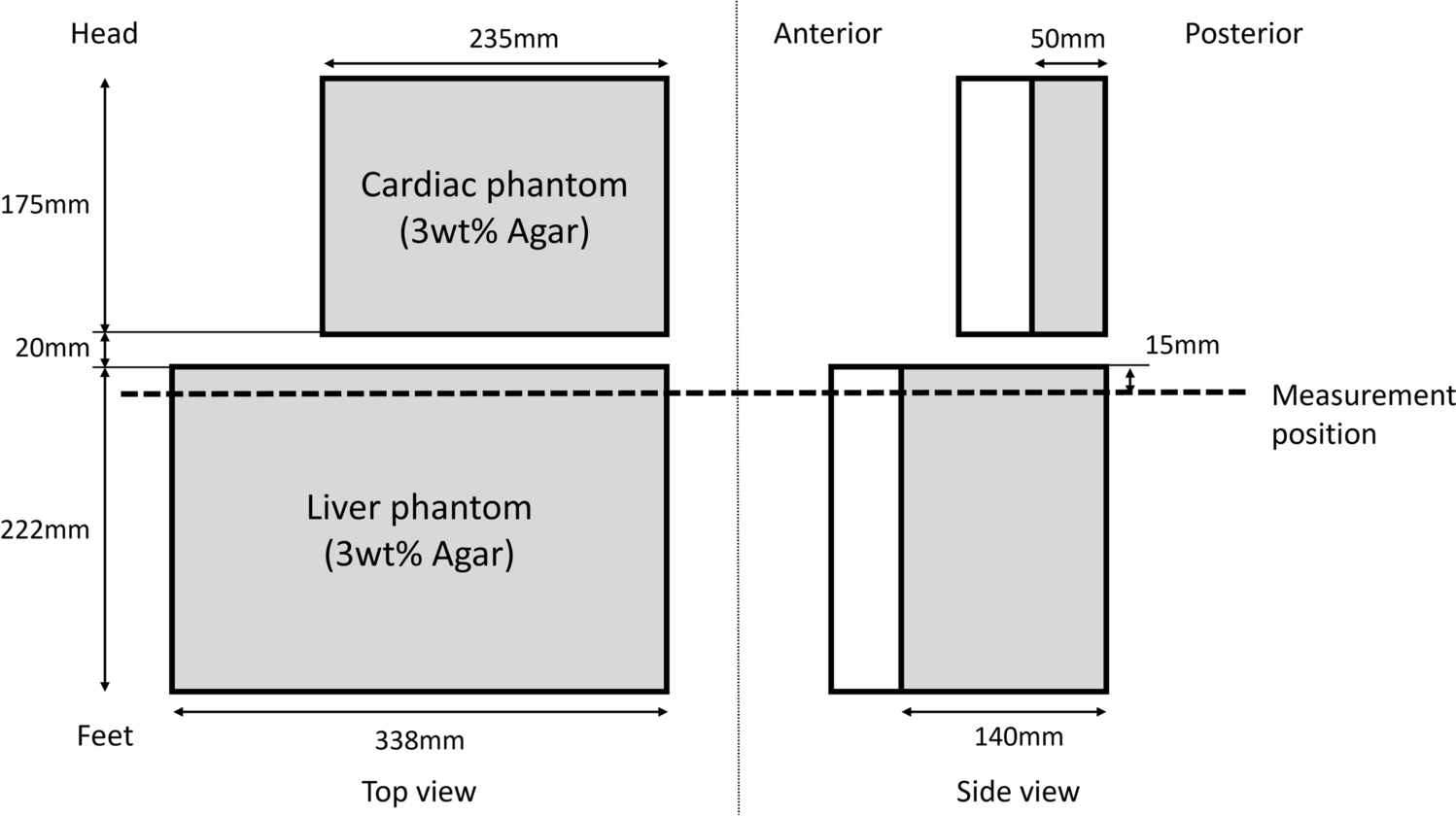 Pulsation artifact reduction using compressed sensitivity encoding in Gd-EOB-DTPA contrast-enhanced magnetic resonance imaging