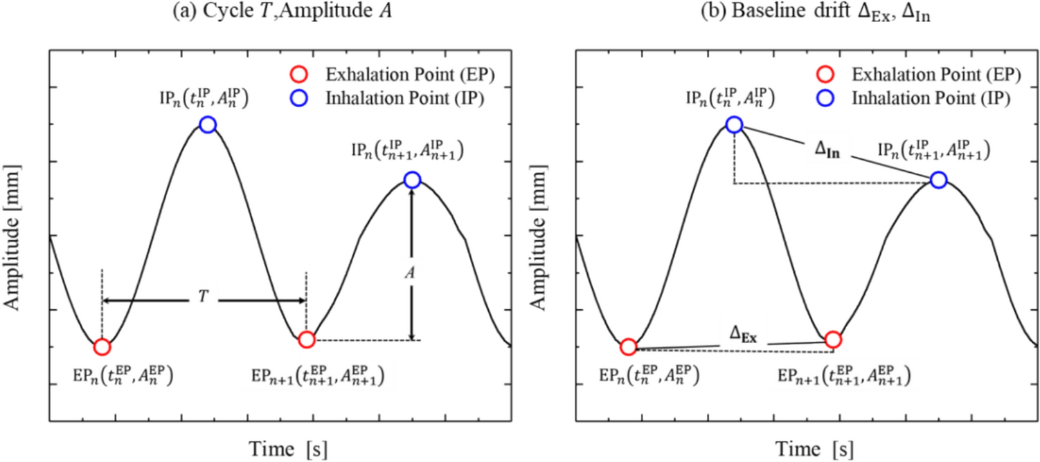 Optimization of image reconstruction technique for respiratory-gated lung stereotactic body radiotherapy treatment planning using four-dimensional CT: a phantom study